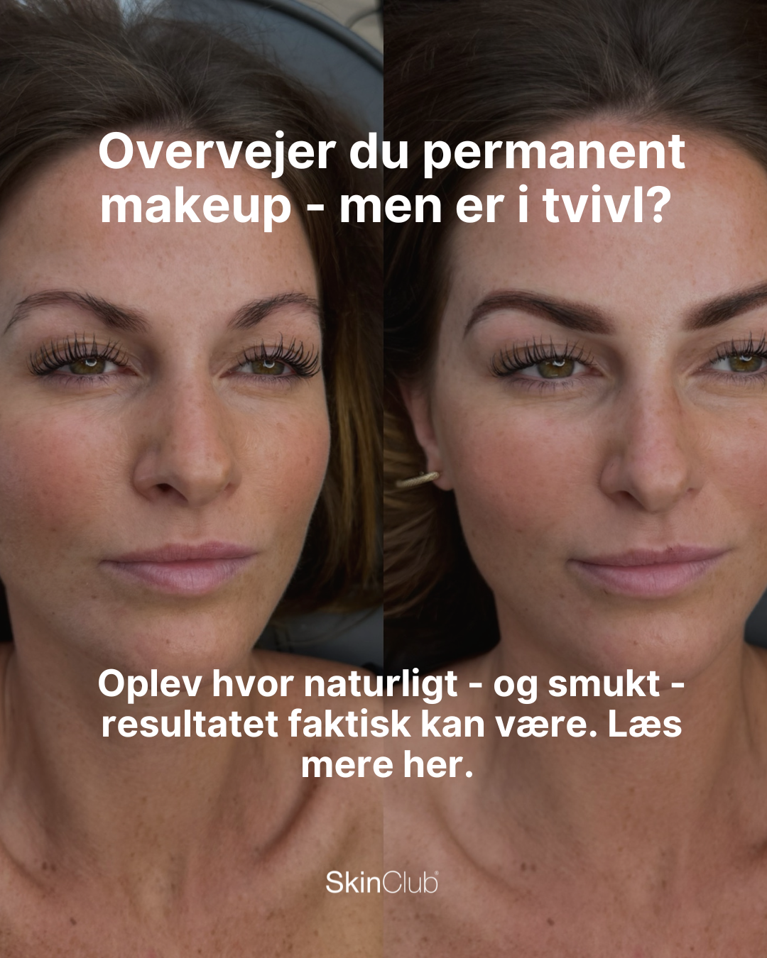 Düwald Skinclub Facebook ad from Dec 15, 2025