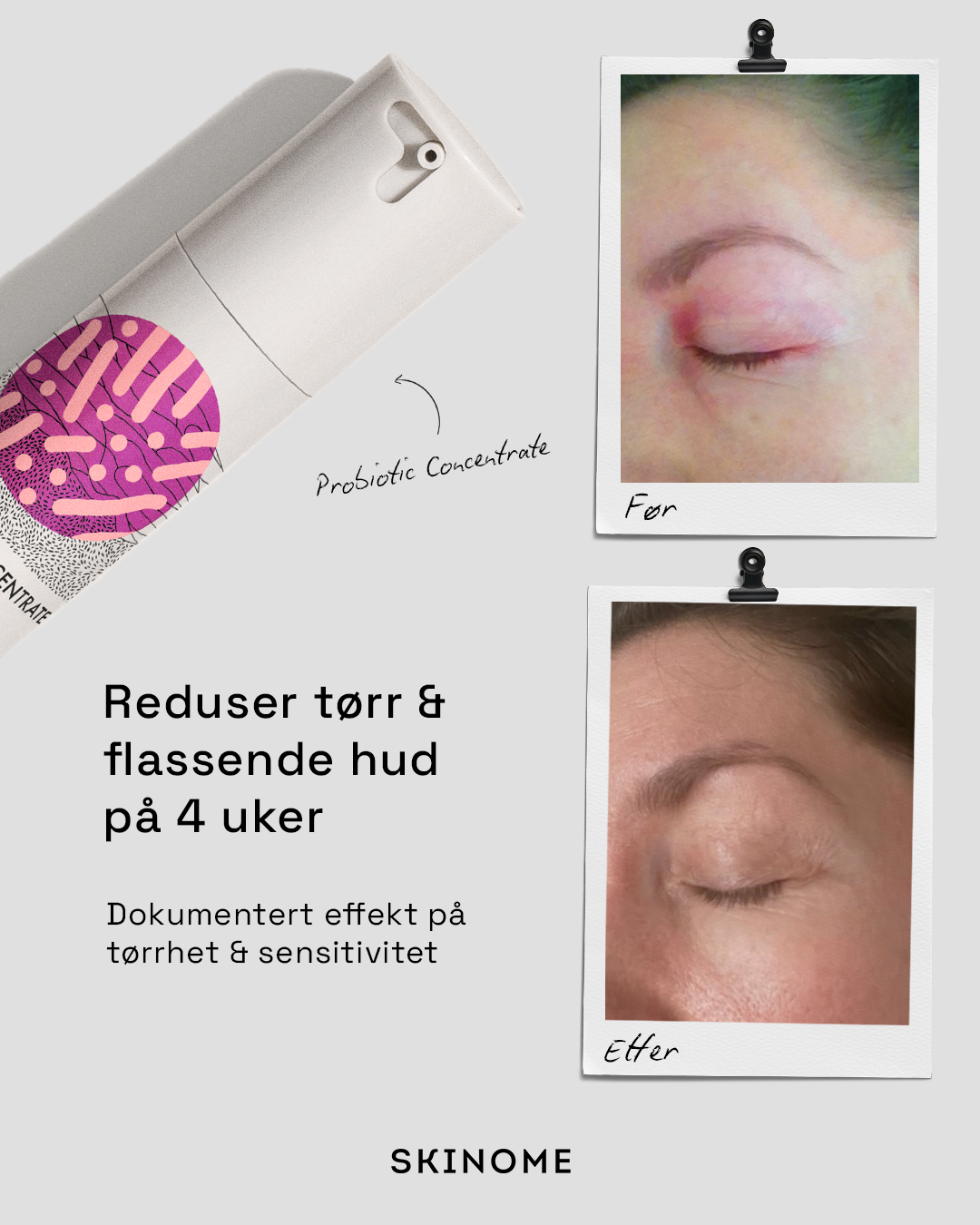 Skinome Facebook ad