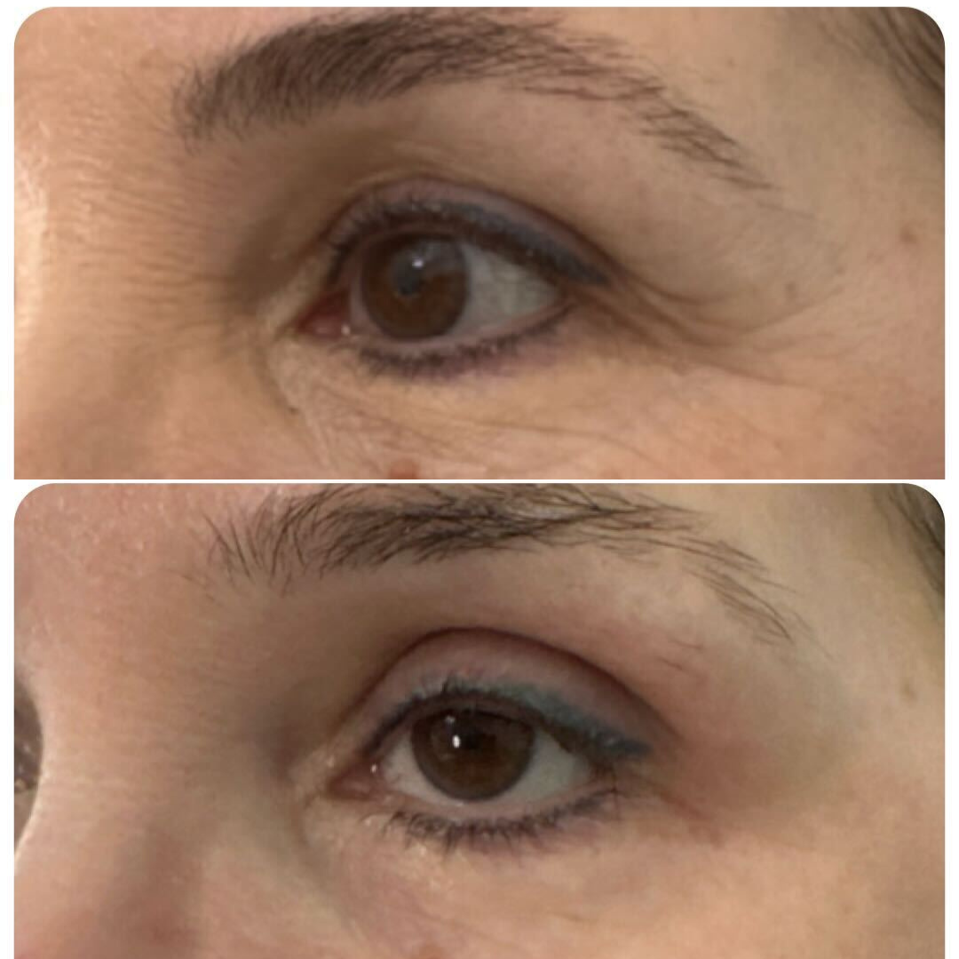 True You Skin Clinics Facebook ad