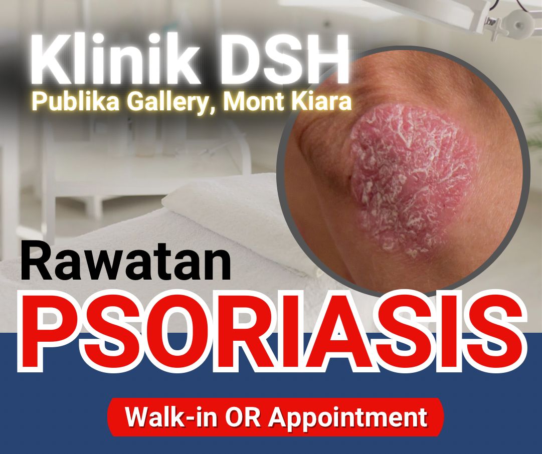 Klinik DSH Signature -DSH Group Facebook ad: Doktor, kulit saya bersisik, tebal, dan semua orang…