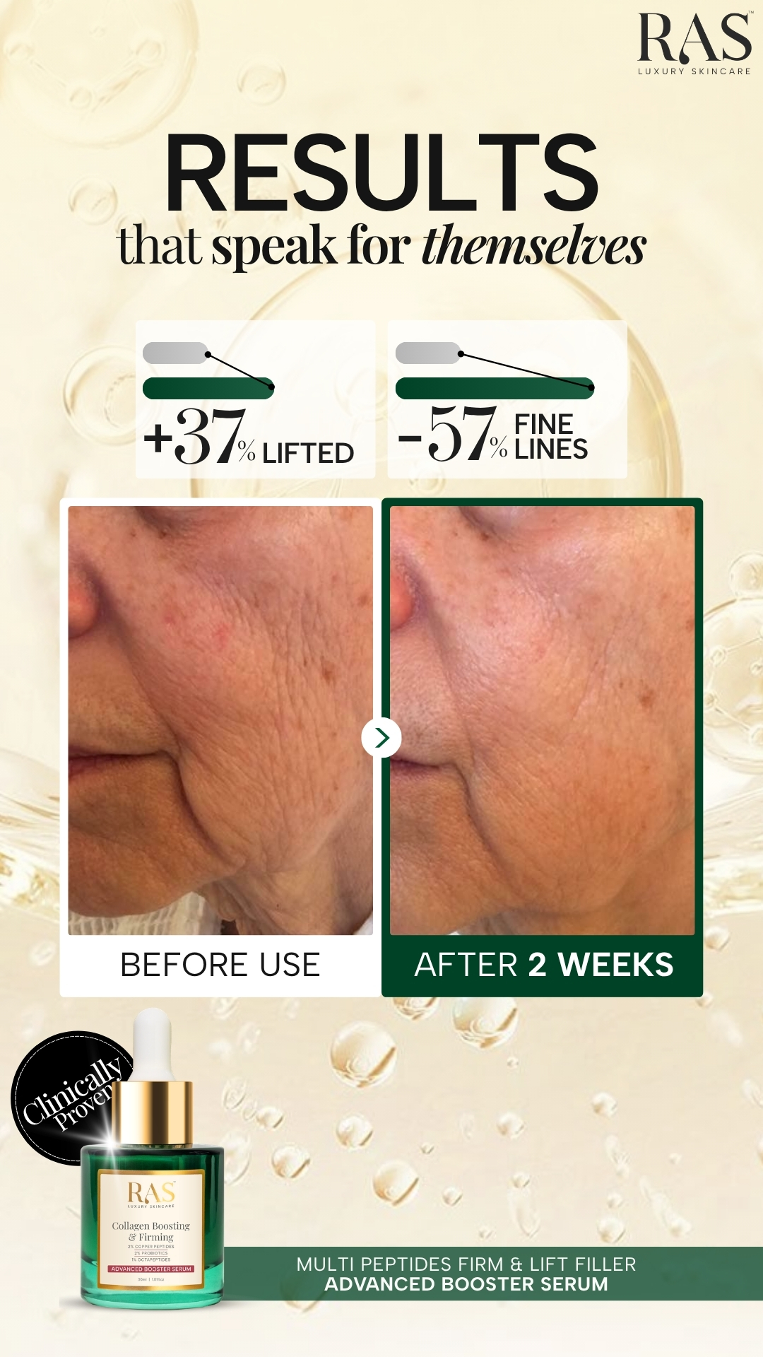 RAS Luxury Oils Facebook ad