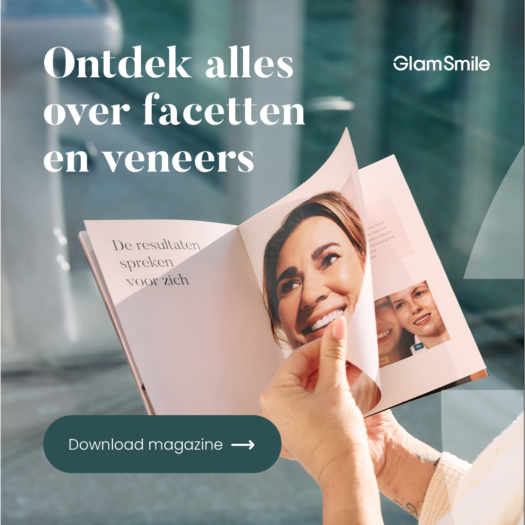 GlamSmile Belgium Facebook ad