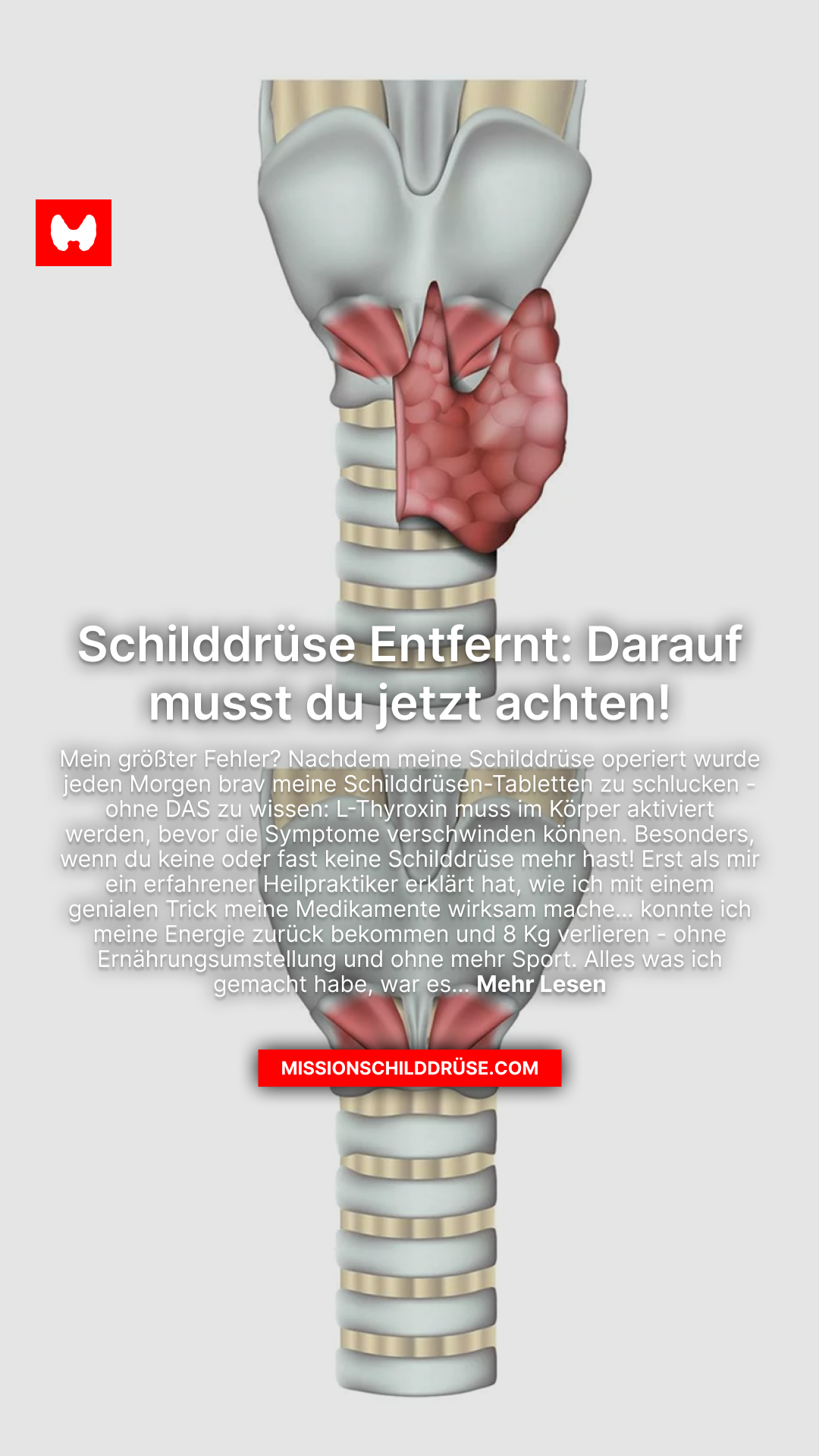 Mission Schilddrüse Facebook ad