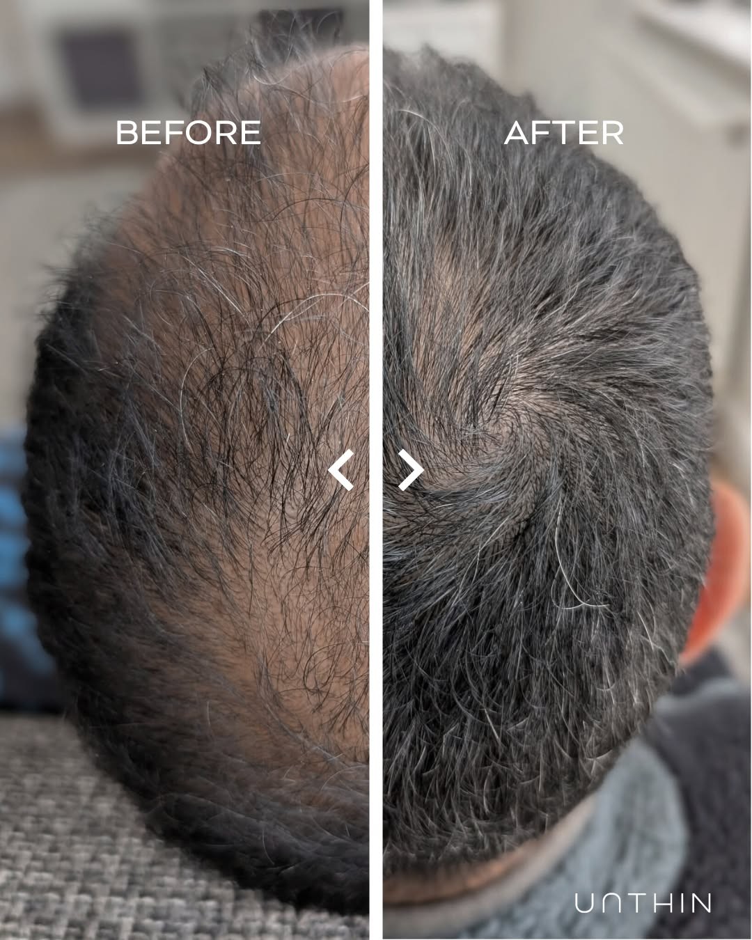 Unthinhair Facebook ad