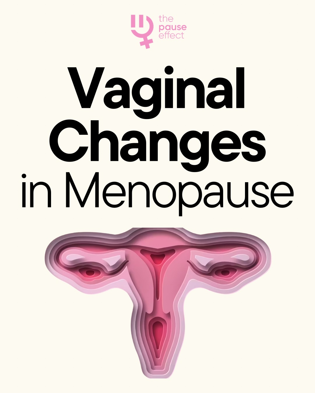 Aisling Dolan Facebook ad: No one warned us that menopause could change…