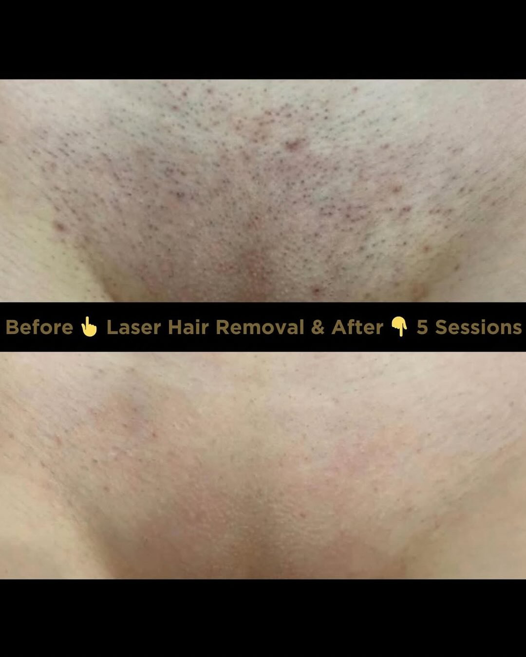 beauty_empire_aesthetics Facebook ad: Hey Tampa