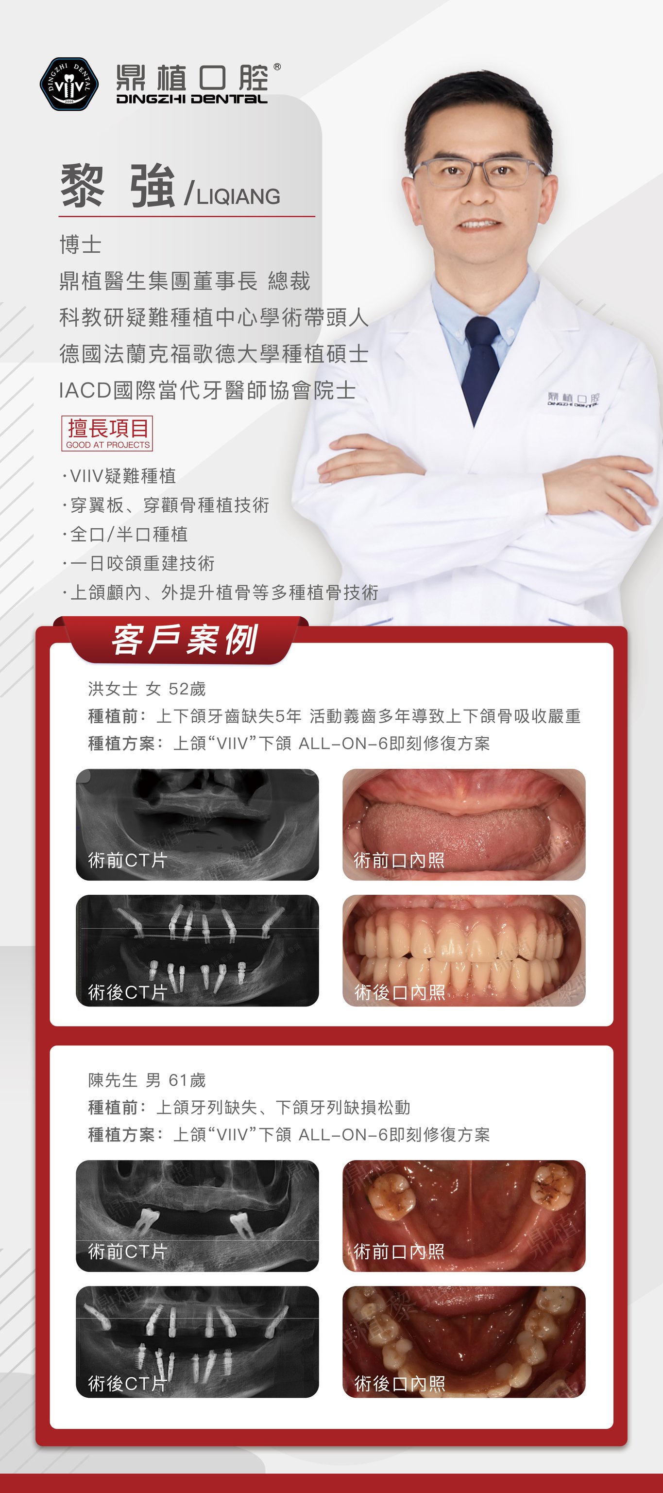 黎強-大灣區疑難種植牙專家 Facebook ad: 致力讓天下沒有種不了的牙