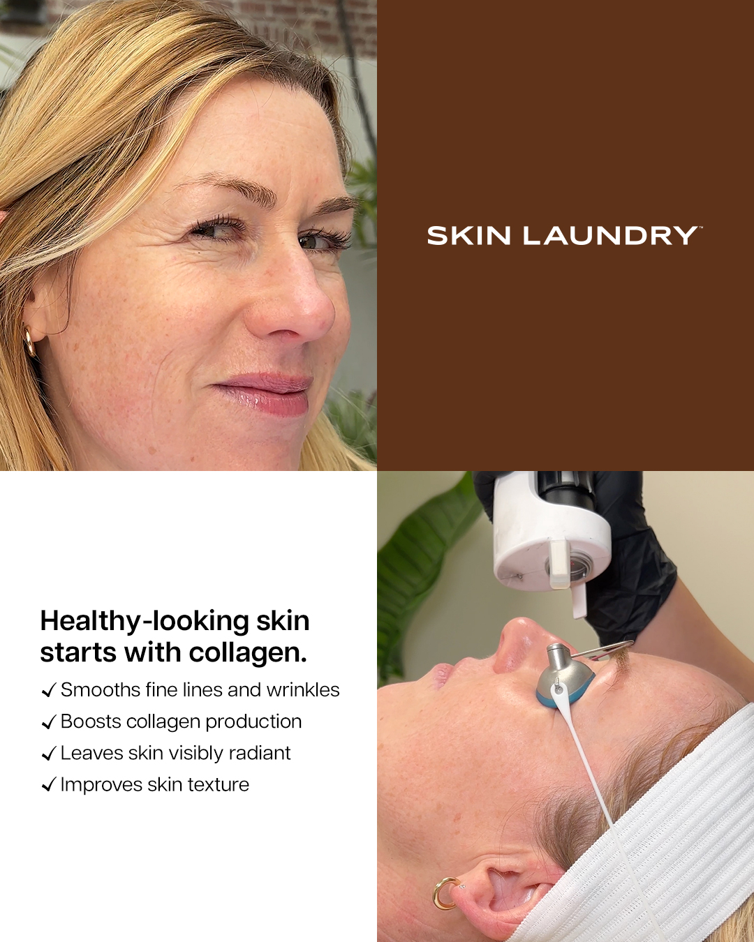Skin Laundry Facebook ad