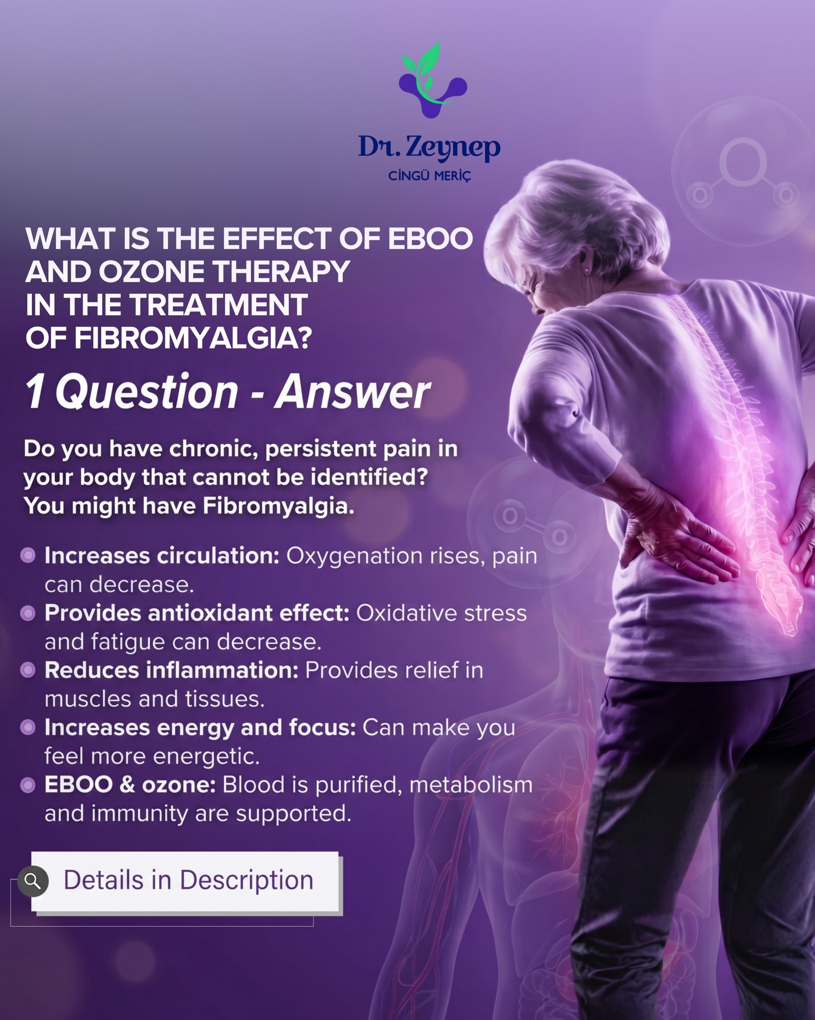 Dr. Zeynep Cingü Meriç - EBOO Theraphy Facebook ad: Fibromyalgia may present with widespread muscle pain…