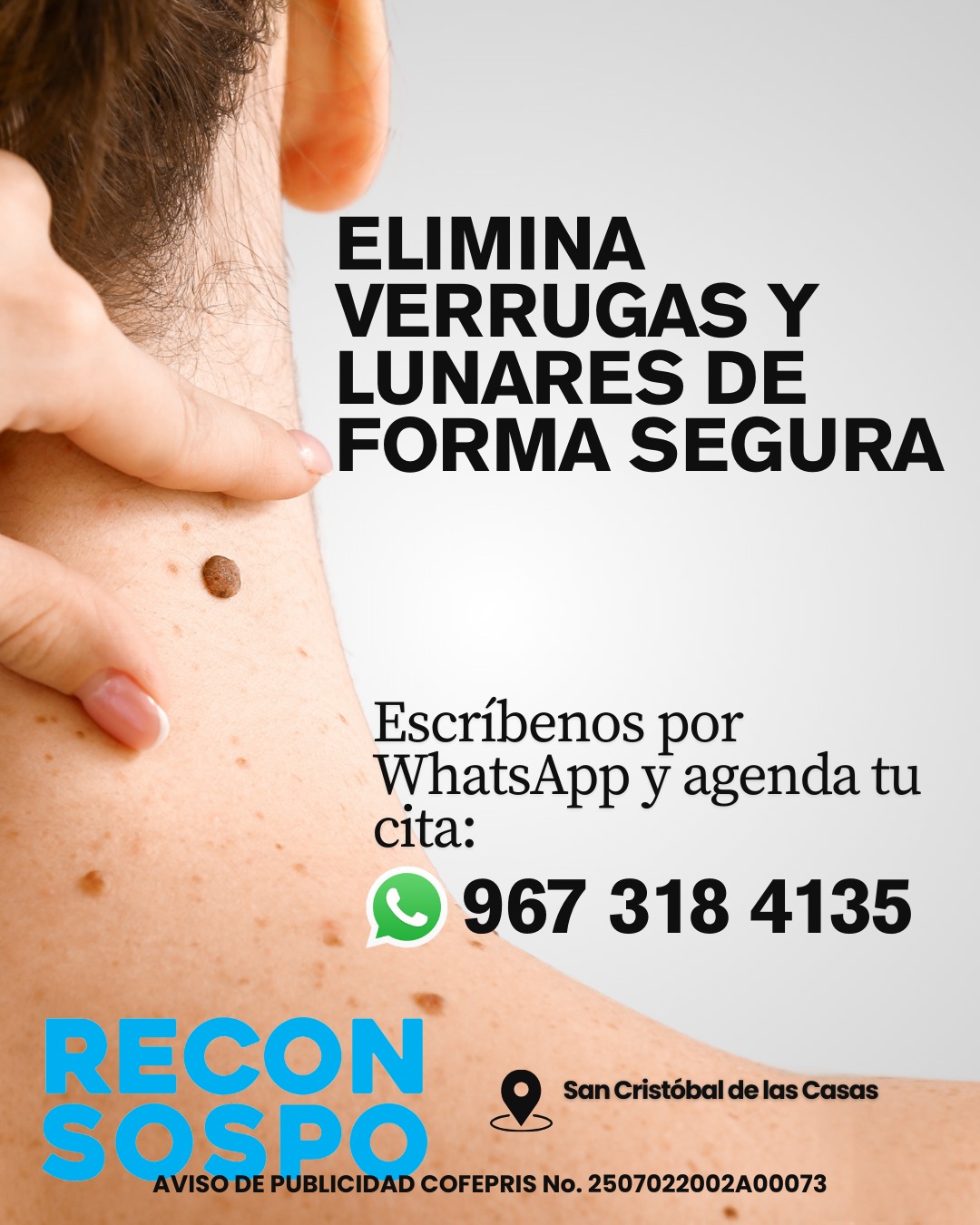 Reconsospó - Atención Articular y Estética Facebook ad: ¿Tienes una verruga o un lunar que te…