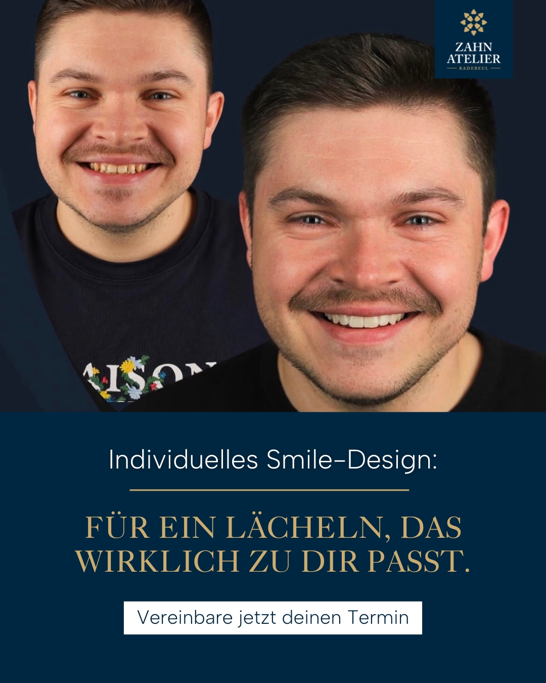 Zahnatelier Radebeul Facebook ad from Jan 30, 2026