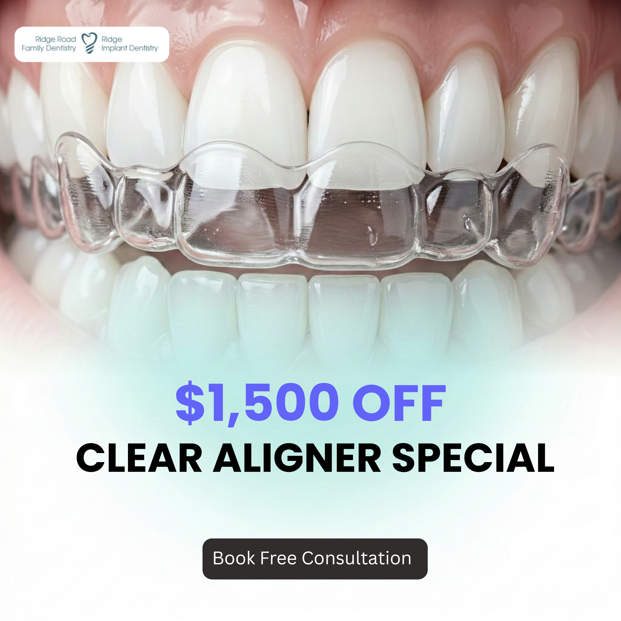 Ridge Road Family Dentistry Facebook ad: Hey Cleveland! New Year Special $1500 OFF Clear Aligner is…