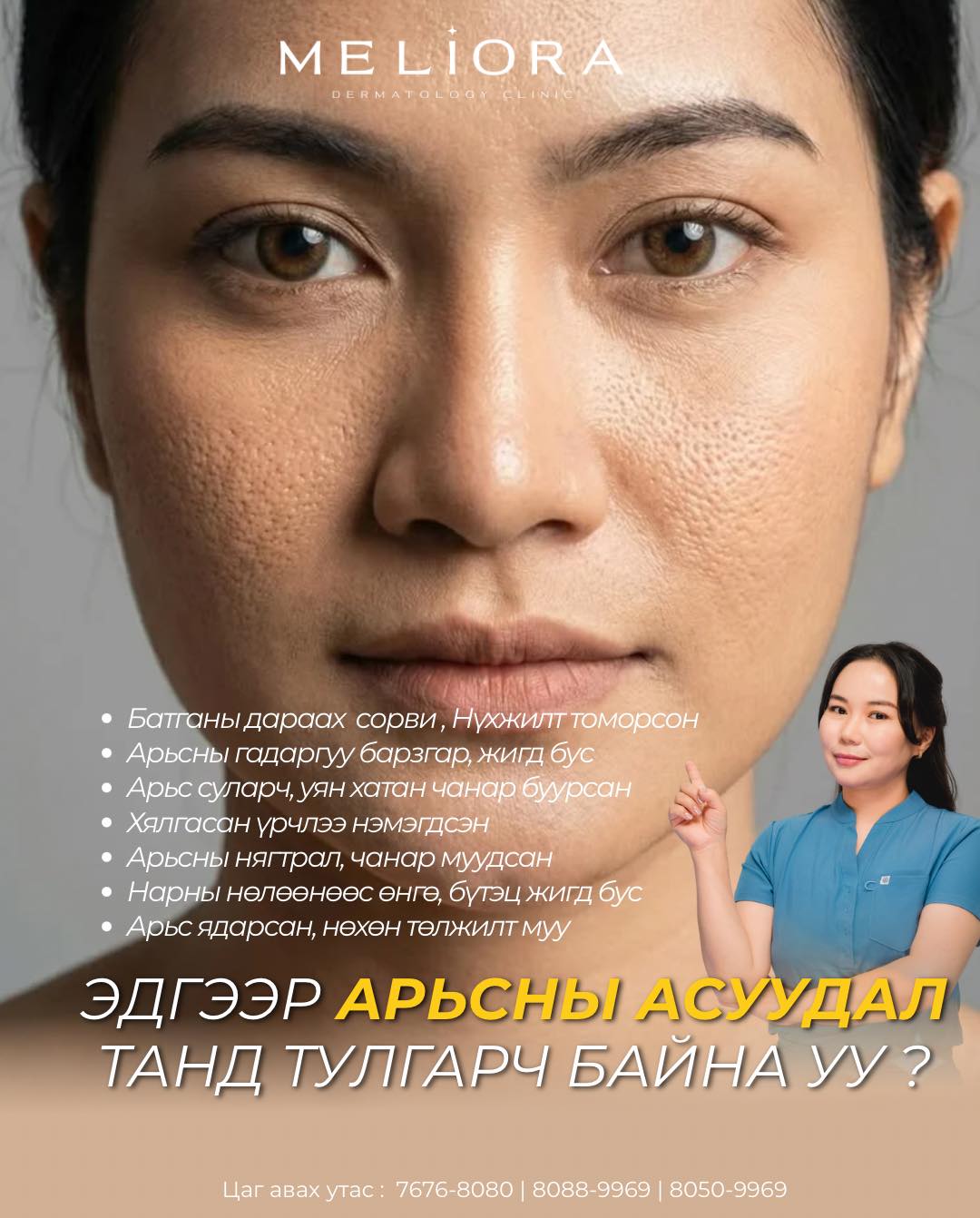 Meliora Dermatology Clinic /Мелиора арьс гоо заслын эмнэлэг Facebook ad: Таны арьсанд дараах асуудлууд үүсэж байна уу?