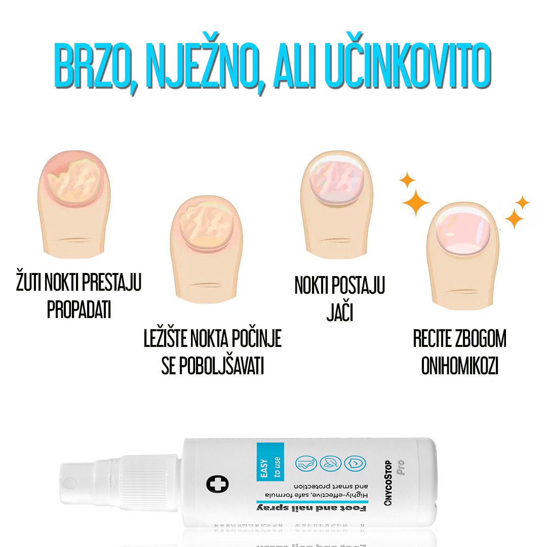 OnycoStop Pro Croatia Facebook ad: BRZO, NJEŽNO, ALI UČINKOVITO