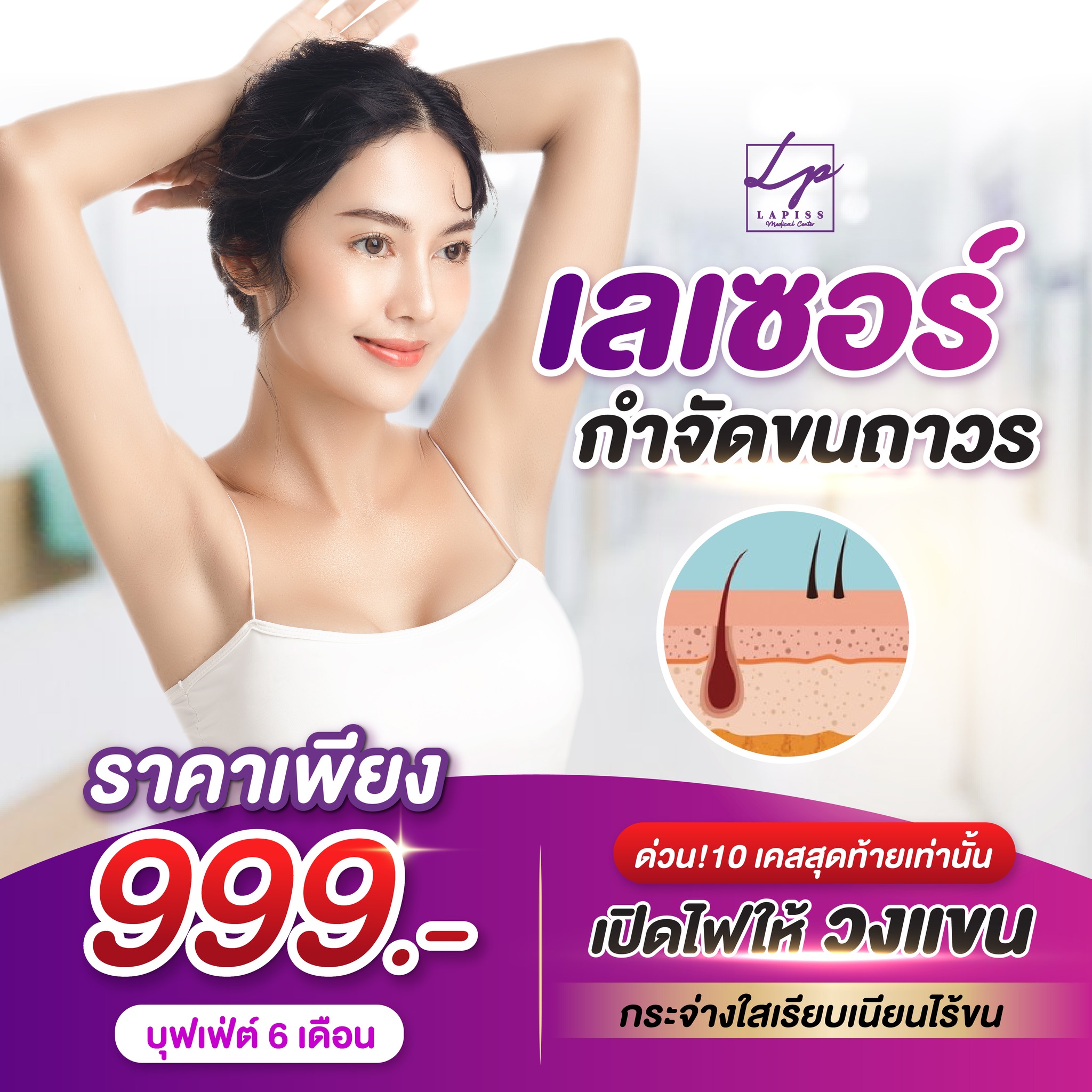 Lapiss medical center ประชาอุทิศ-สุขสวัสดิ์ Facebook ad: เลเซอร์กำจัดขนถาวร ถอนรากถอนโคน