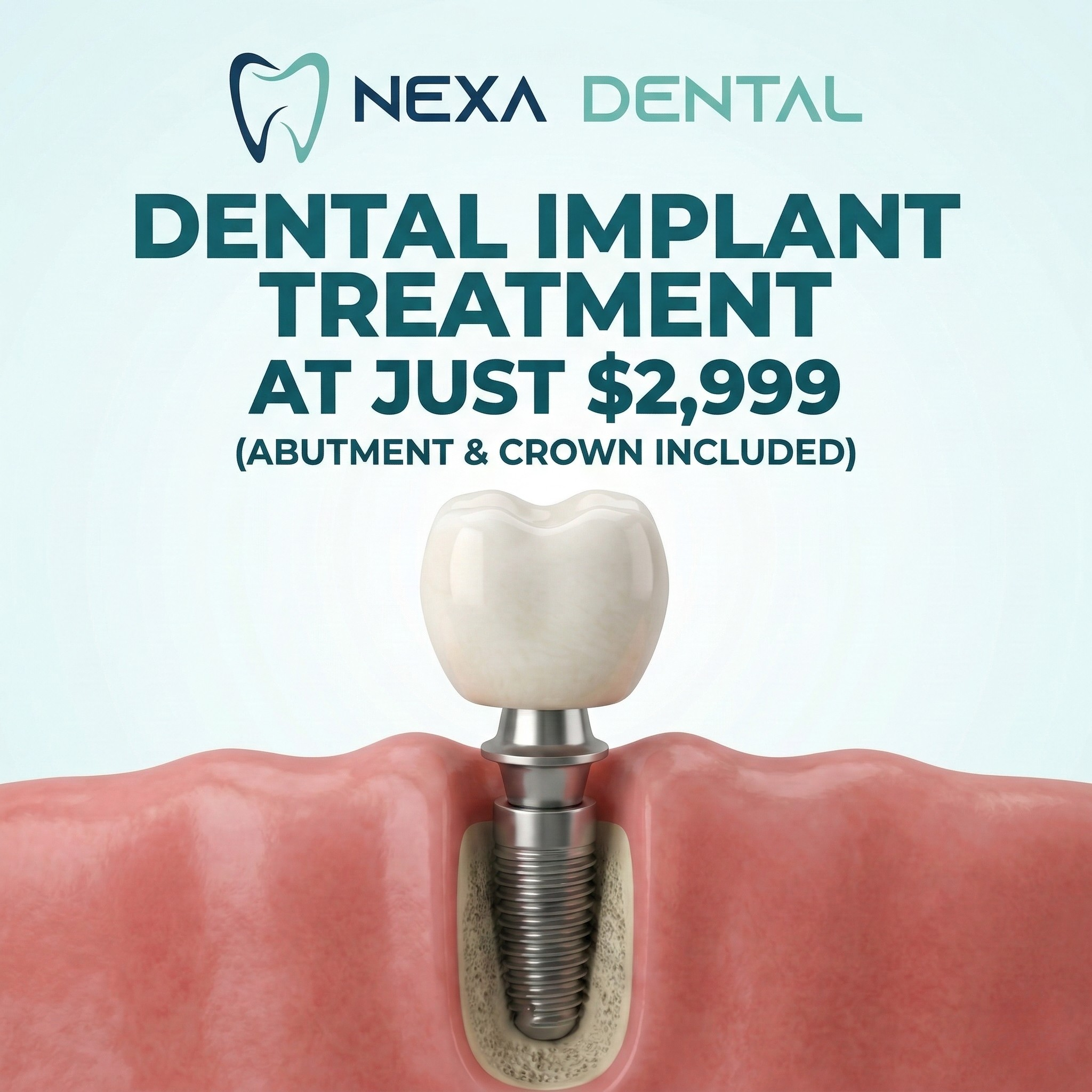 Nexa Dental Facebook ad: Hello Calgary! Dental Implant treatment at just $2999!
