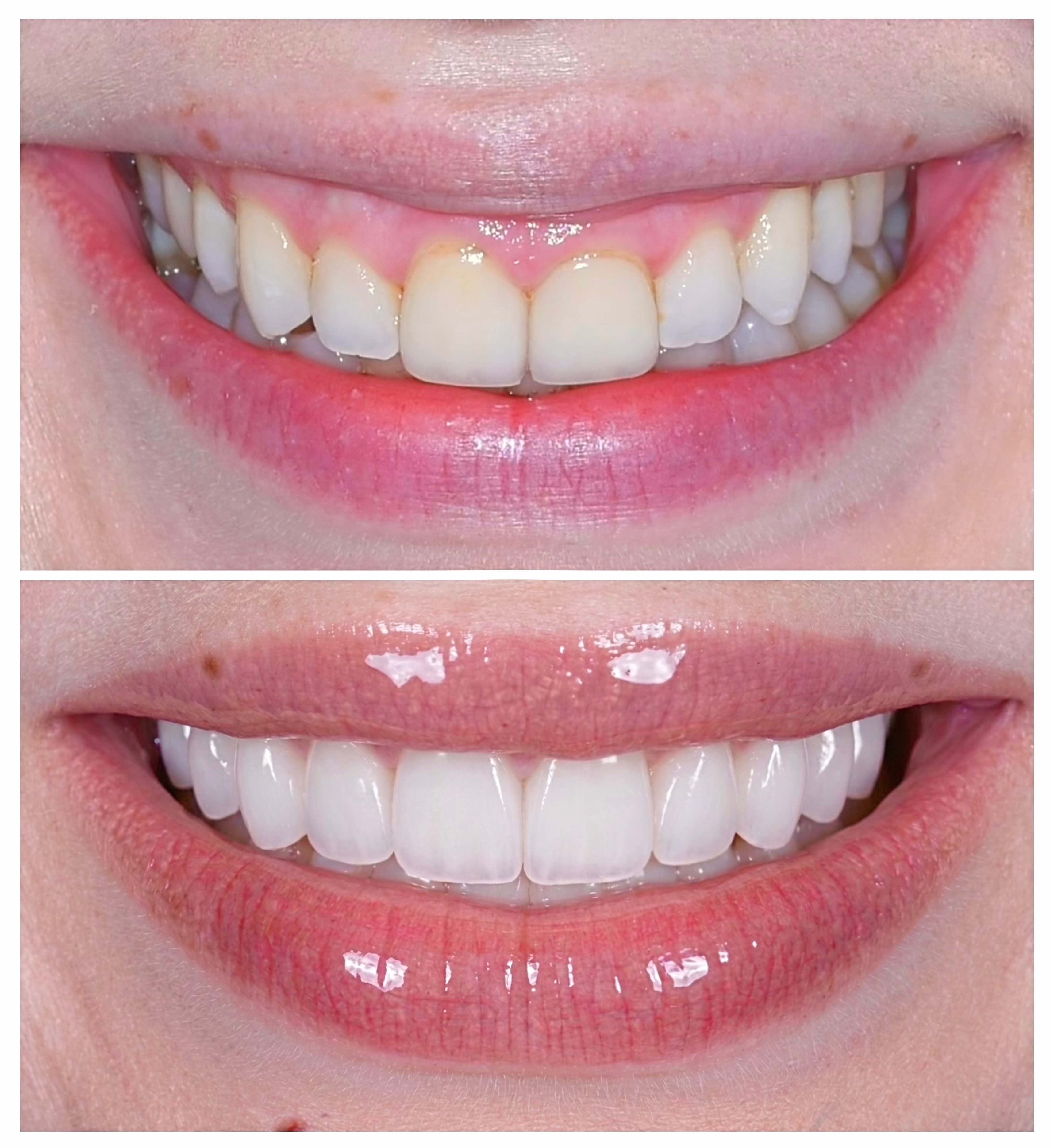 L.A. Smile Specialists Facebook ad: The trend is changing.