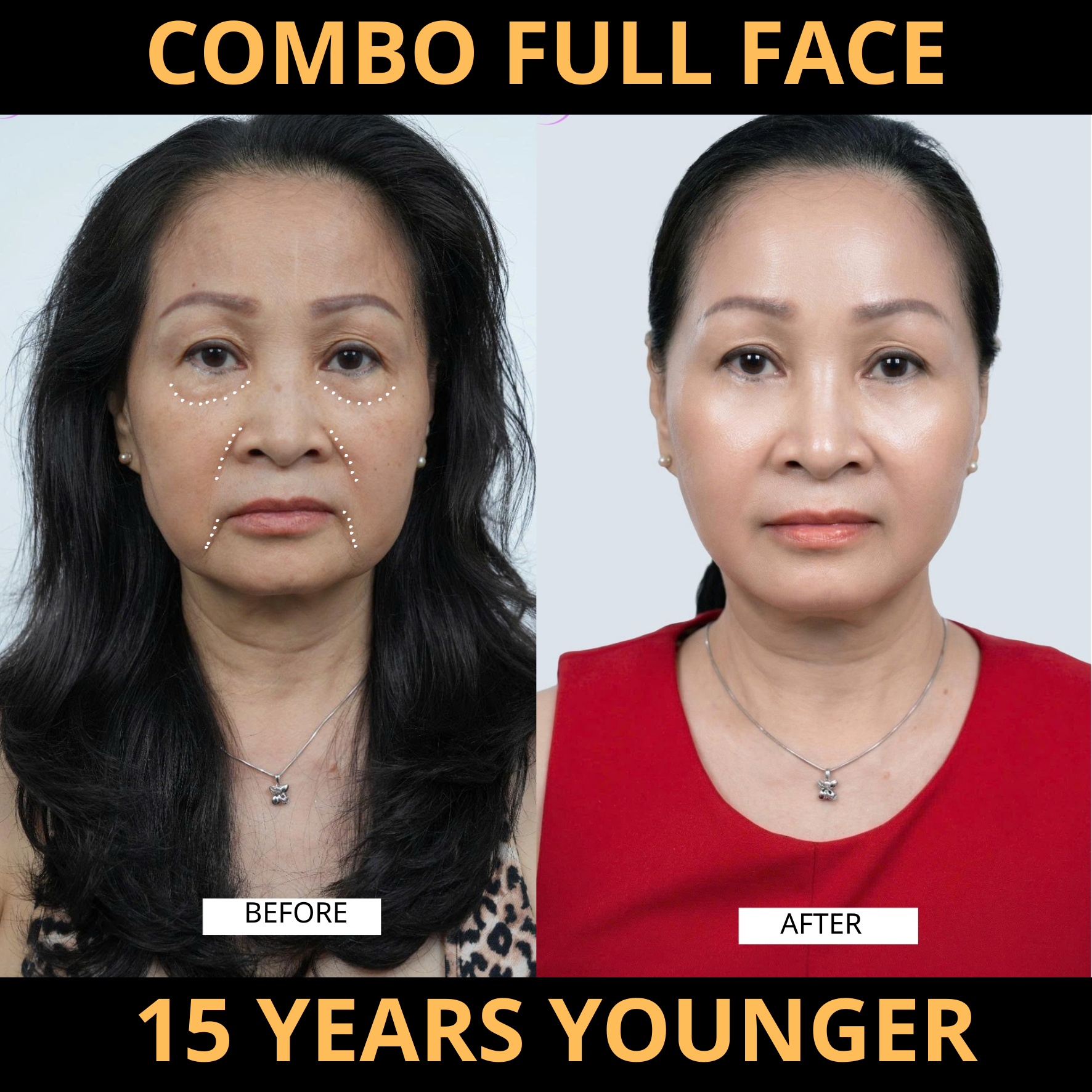 Korean Skin Rejuvenation Technology Facebook ad