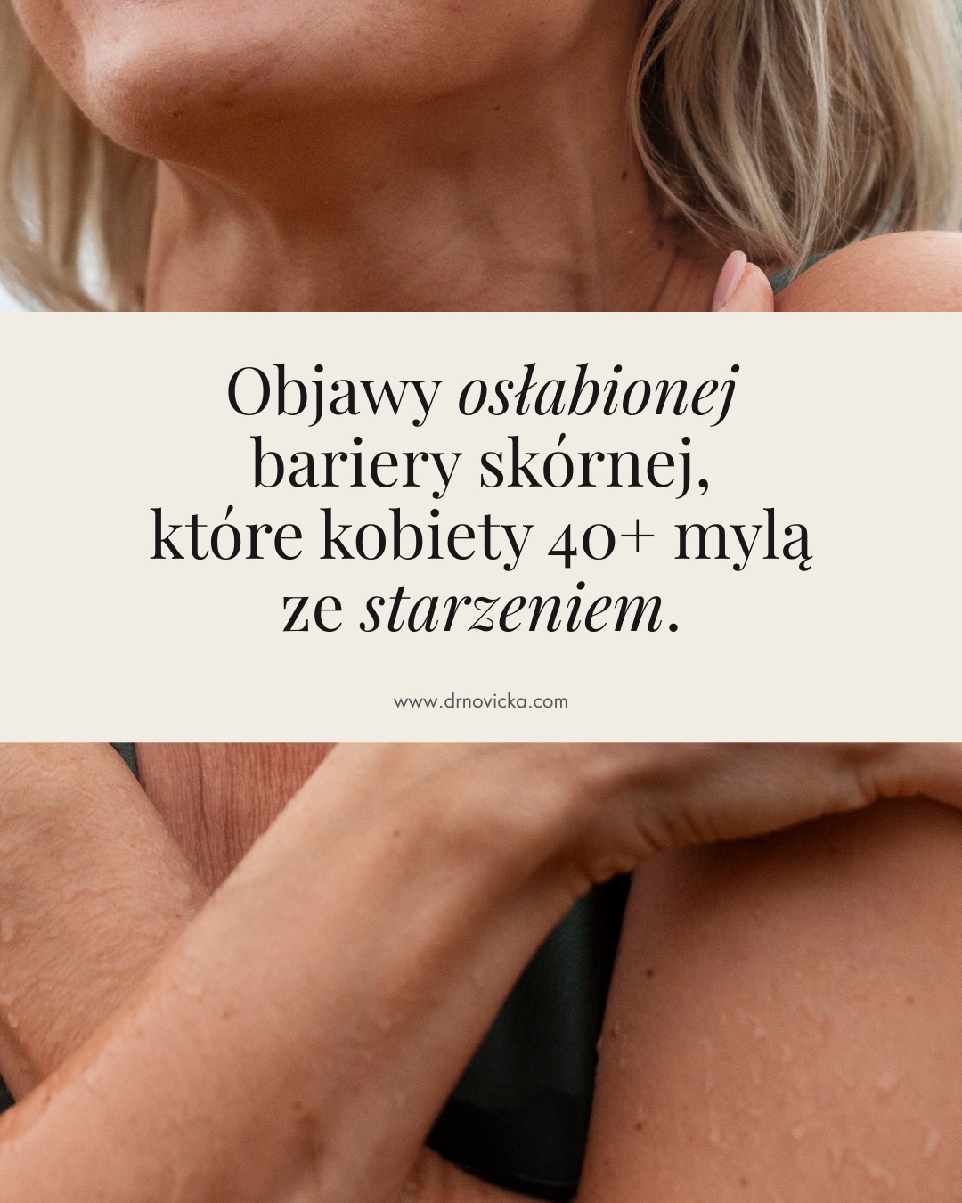 Dr Novicka Facebook ad: Wiele kobiet 40+ interpretuje pieczenie, ściągnięcie czy…
