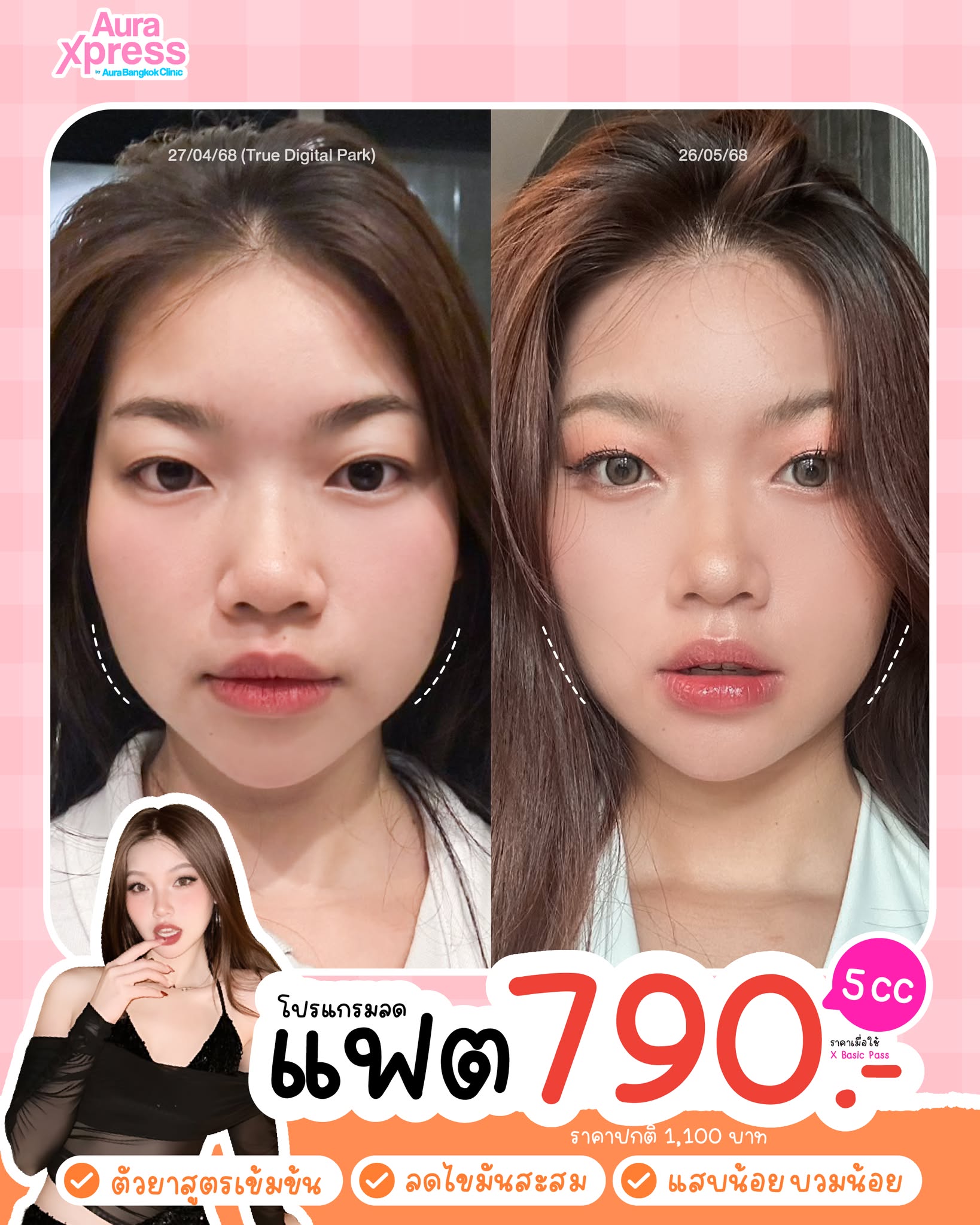 Aura Xpress by Aura Bangkok Clinic Facebook ad