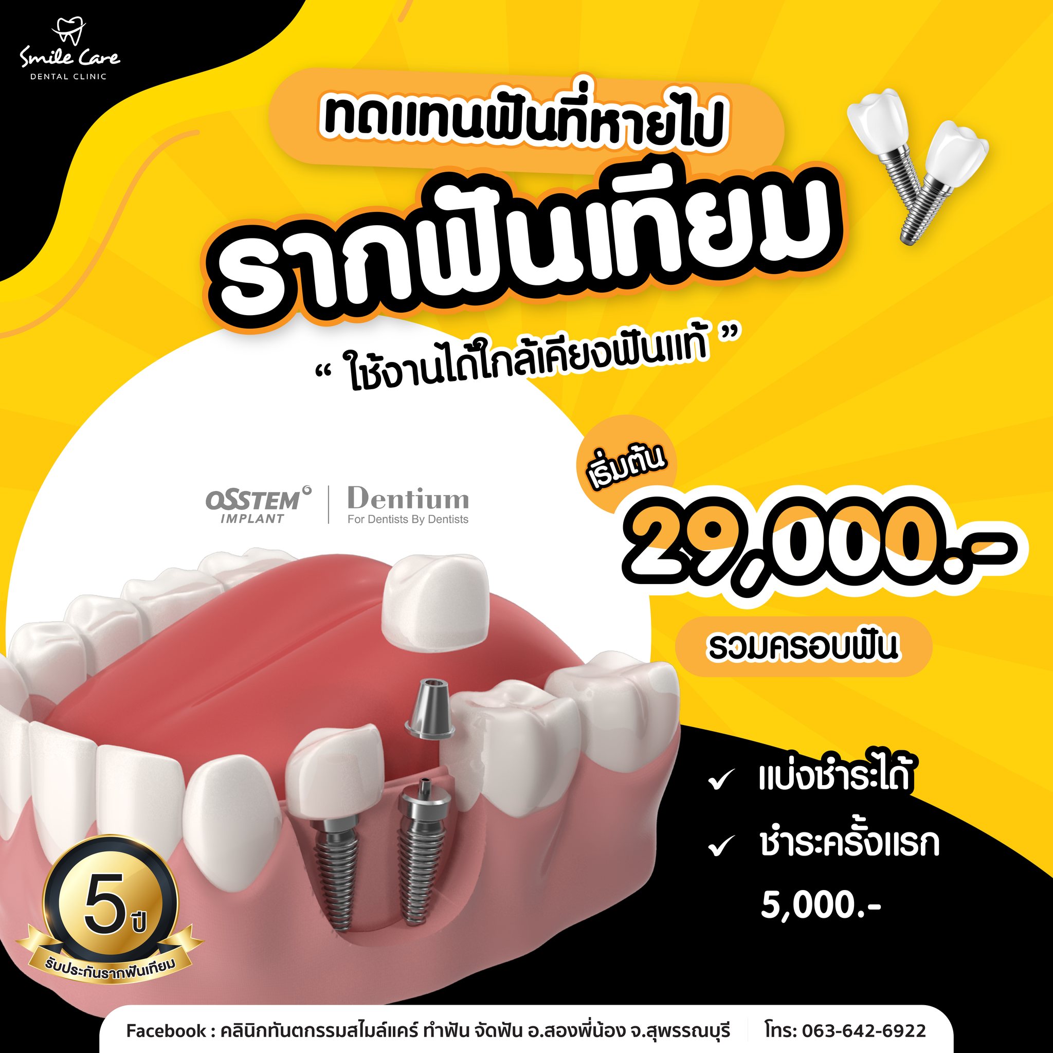 คลินิกทันตกรรมสไมล์แคร์ ทำฟัน จัดฟัน อ.สองพี่น้อง จ.สุพรรณบุรี Facebook ad
