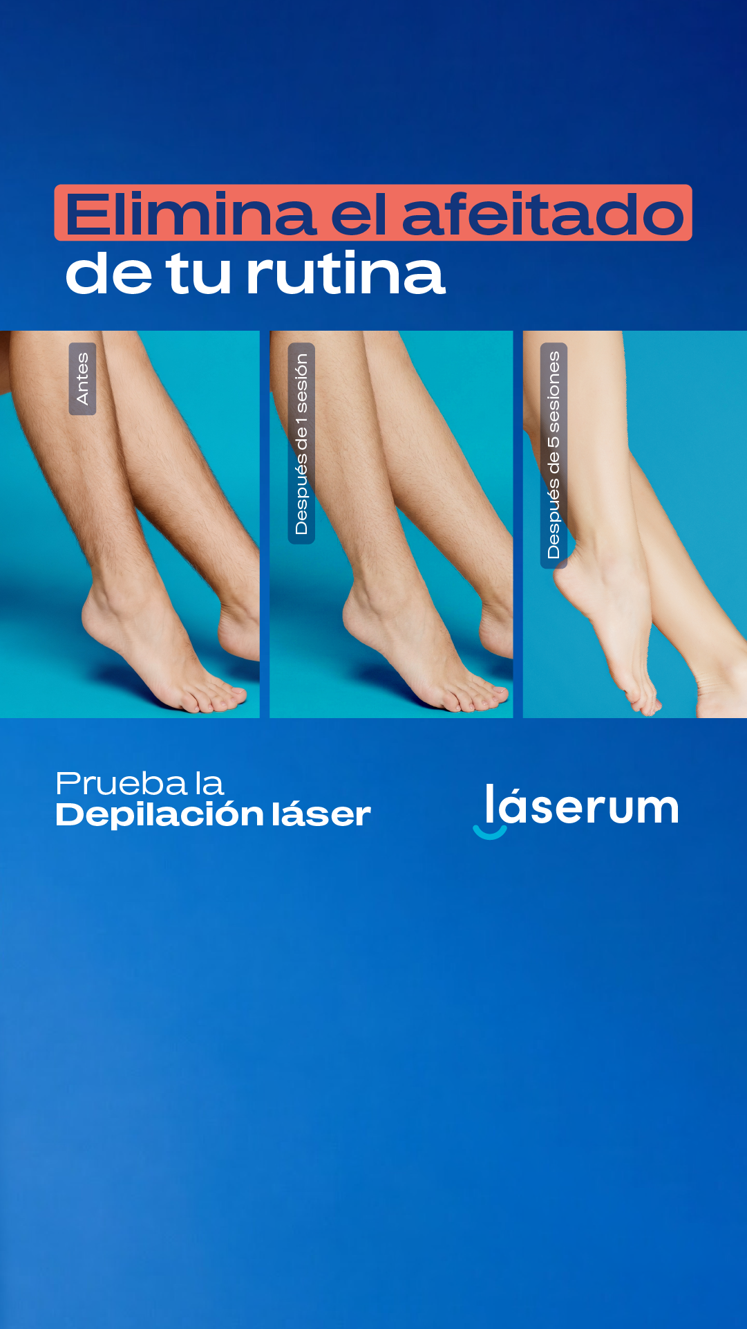 Láserum Facebook ad