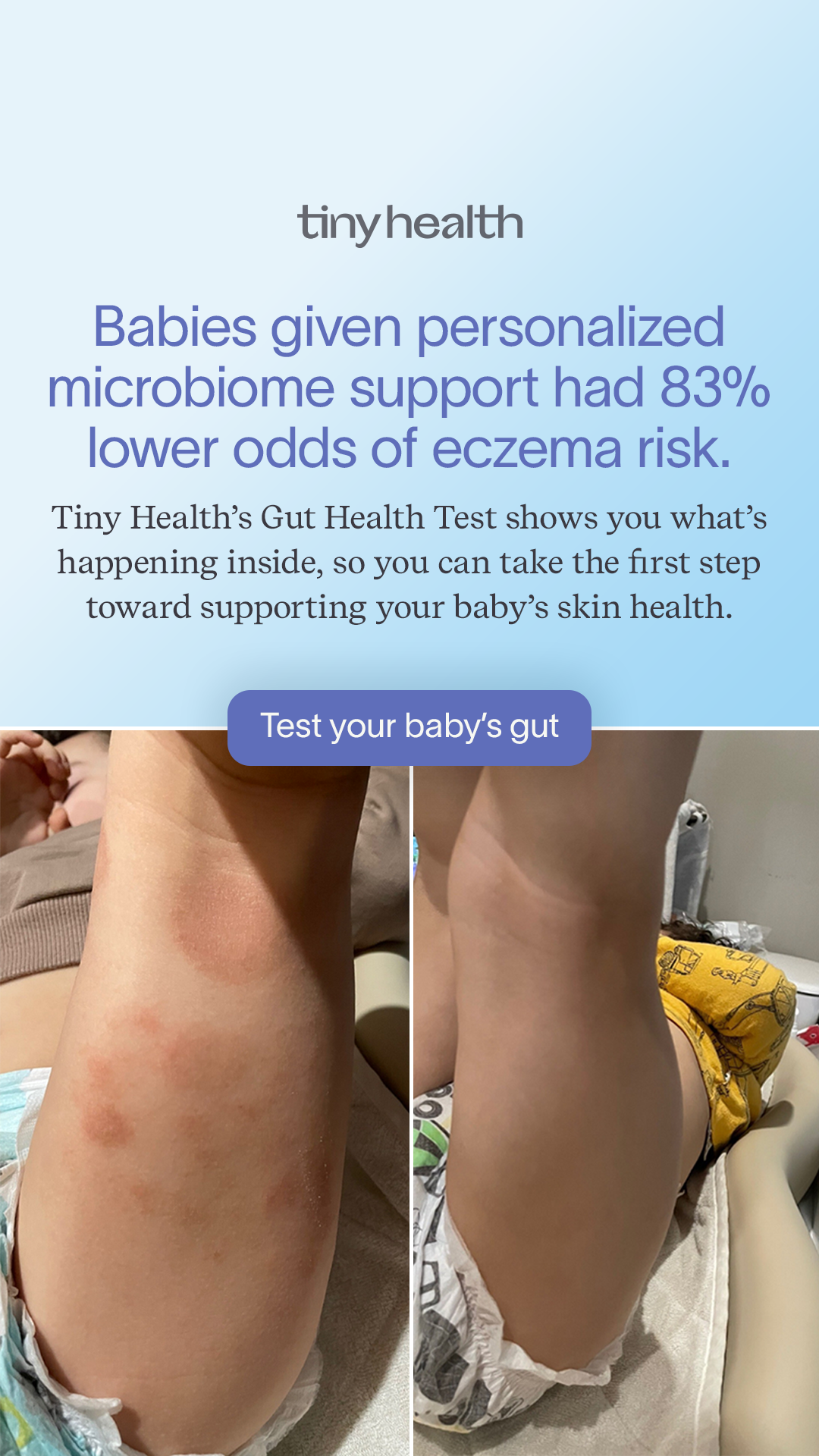 TinyHealth Facebook ad