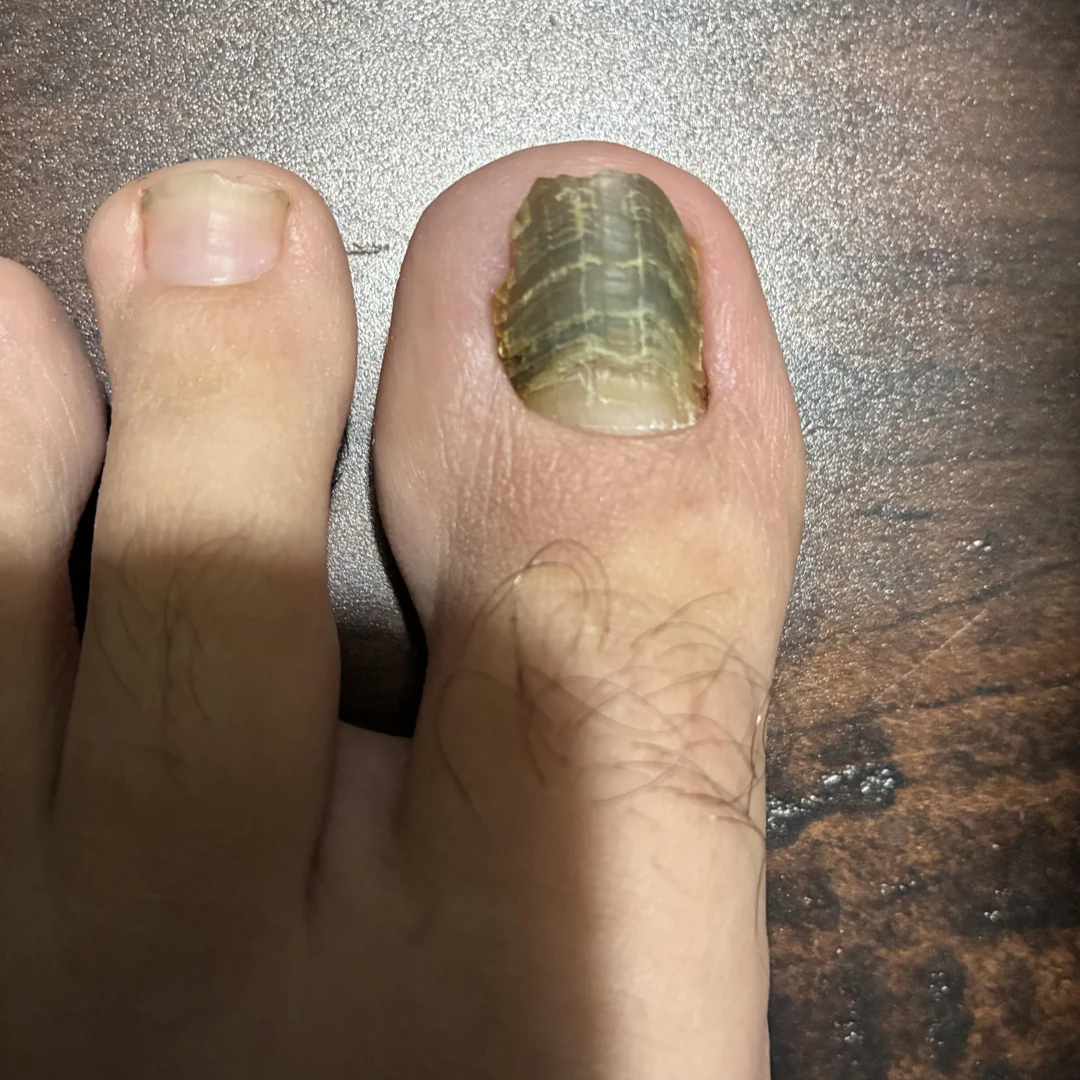 Dr. Jenna Blake, Podiatrist Facebook ad
