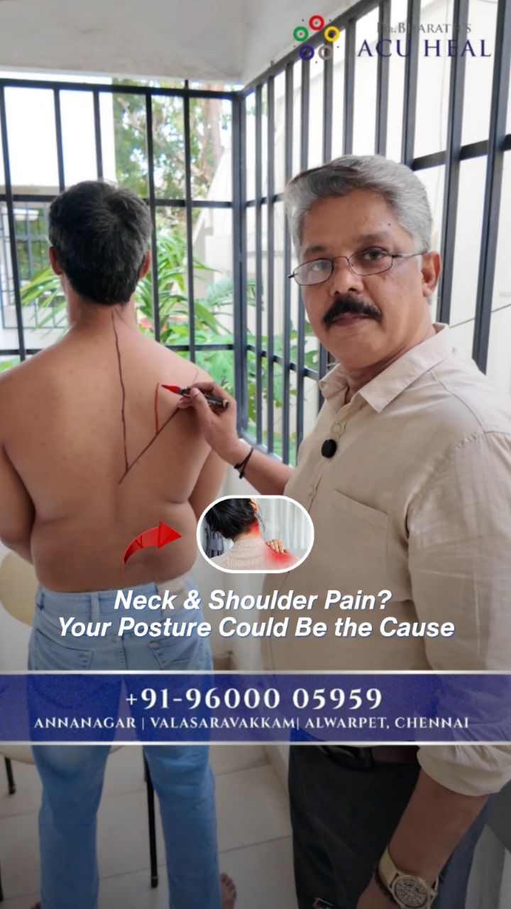 Dr. Bharath's Acu Heal Facebook ad: Neck, shoulder, or upper-back tightness making everyday…