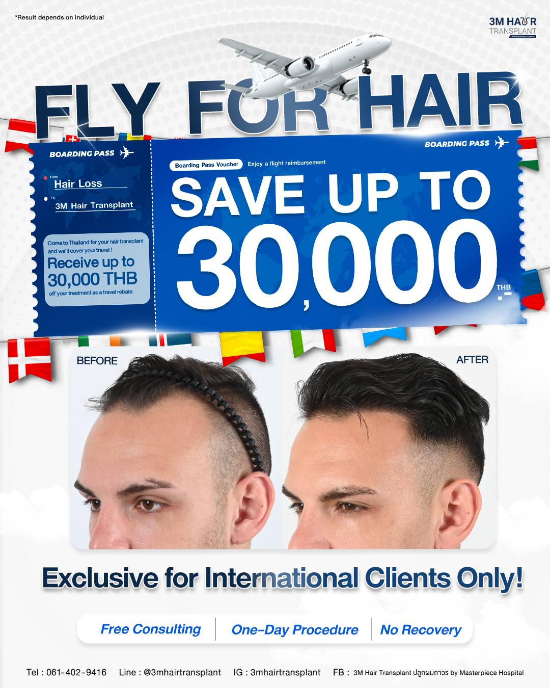 3M Hair Transplant ปลูกผมถาวร by Masterpiece Hospital Facebook ad