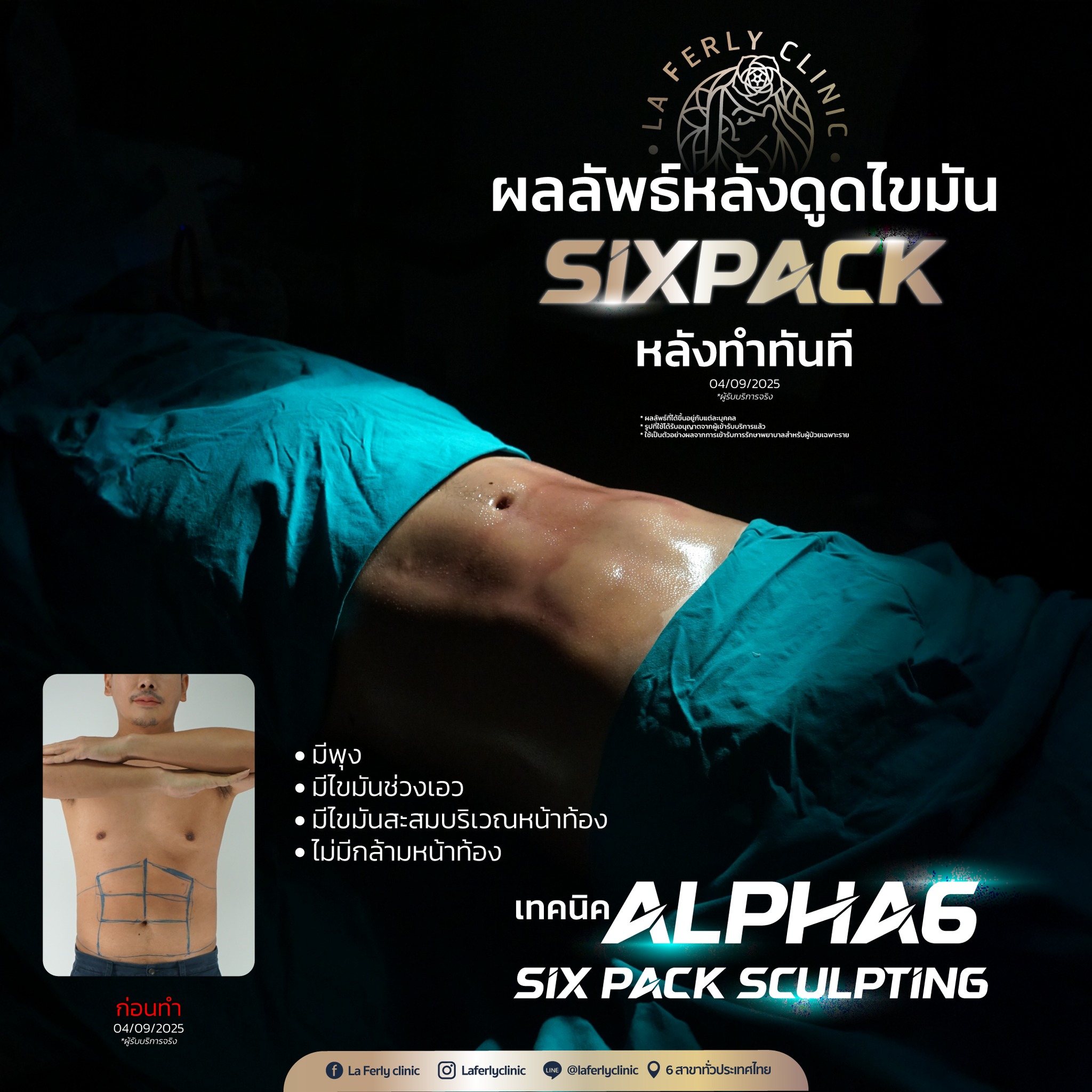 La Ferly clinic Facebook ad
