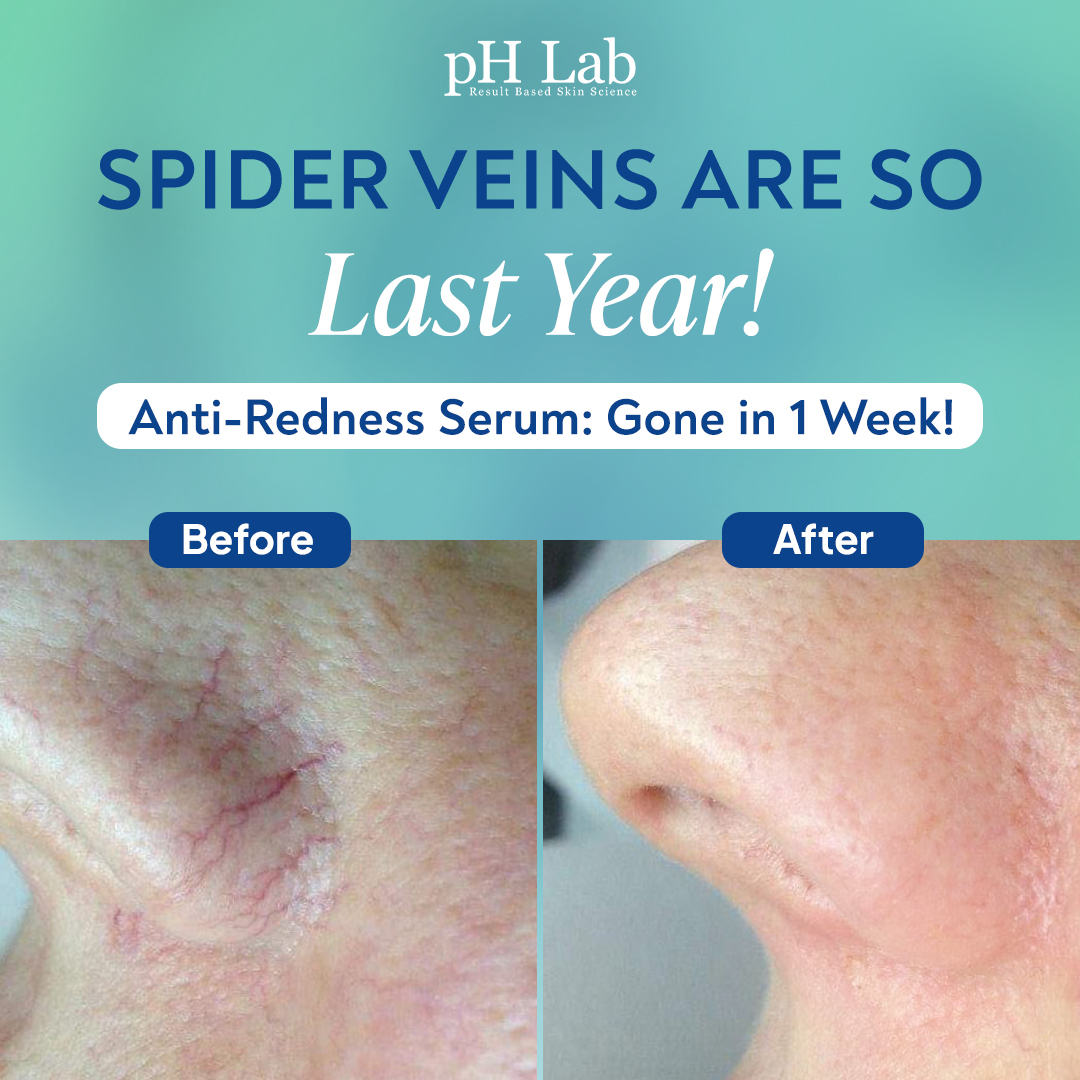 Anti-Redness US Facebook ad