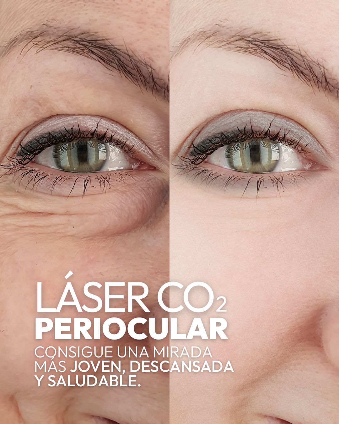 Clínica Oftalmológica Rahhal Facebook ad
