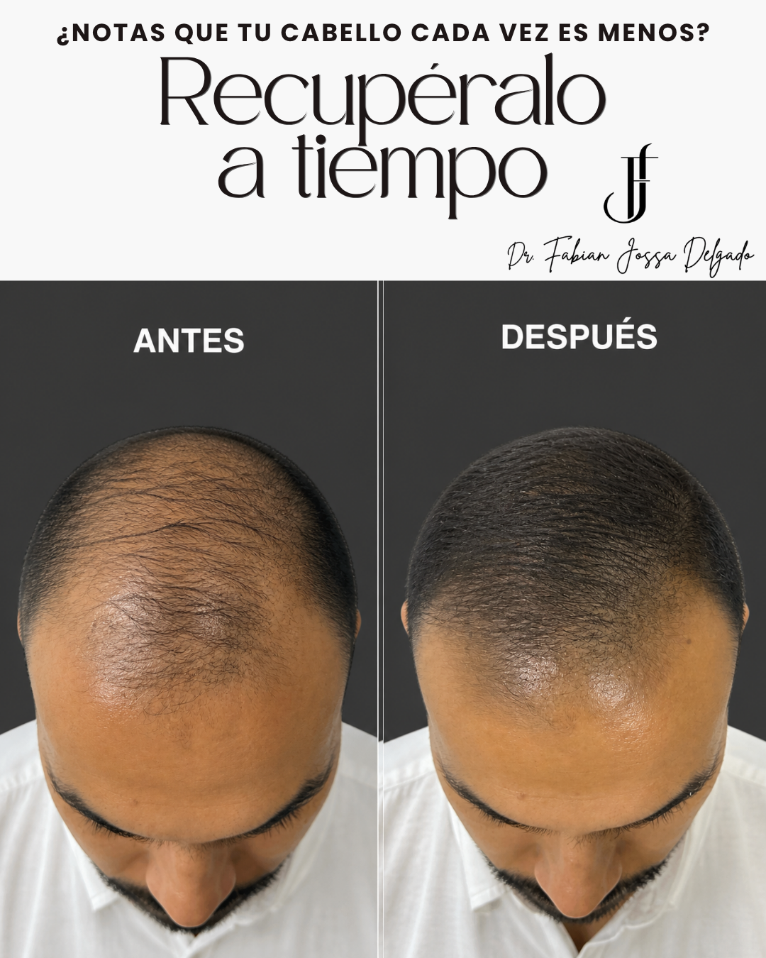 Dr. Fabian Jossa Facebook ad: Recupera tu cabello a tiempo