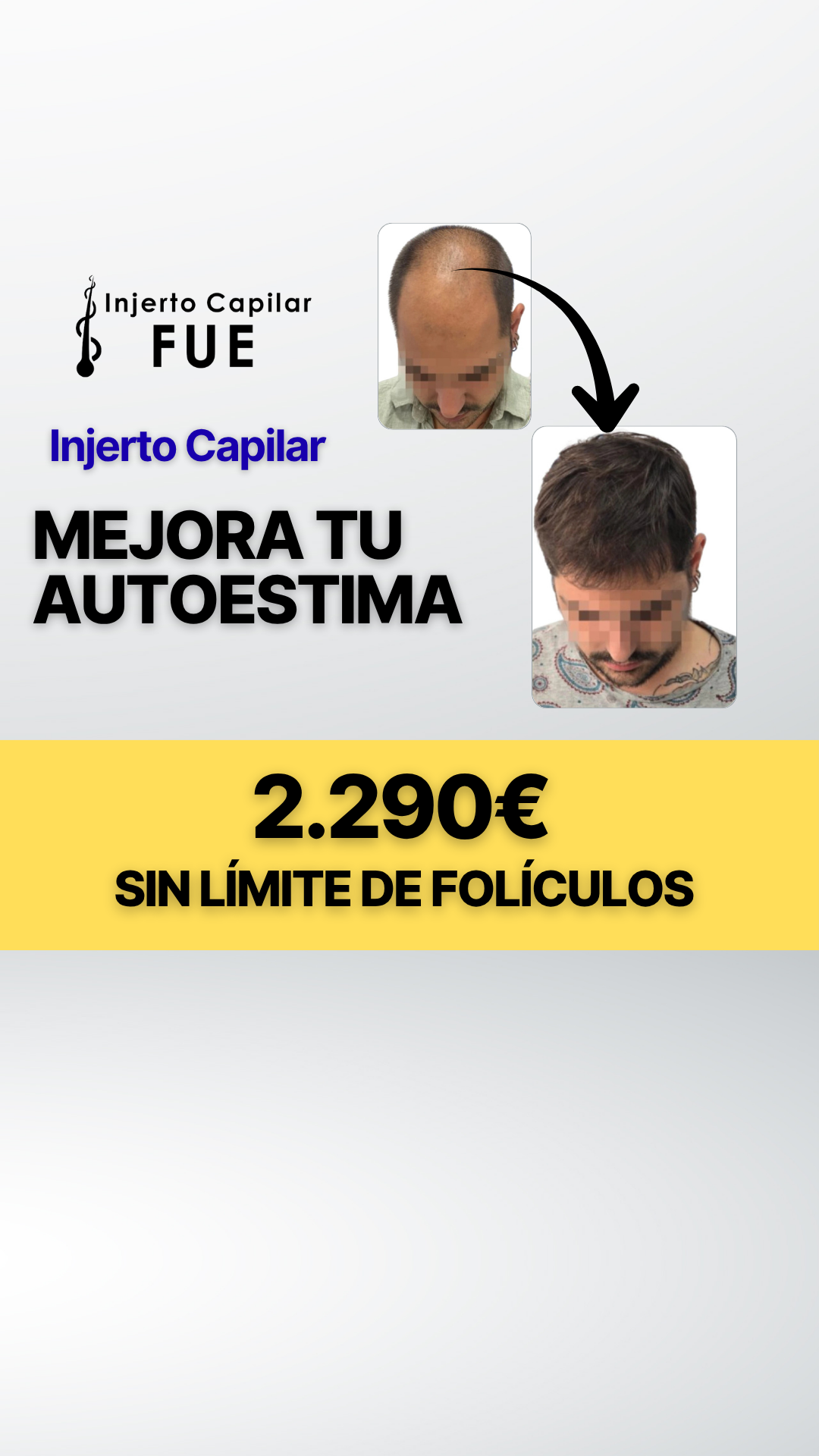 Clínicas Injerto Capilar FUE Facebook ad