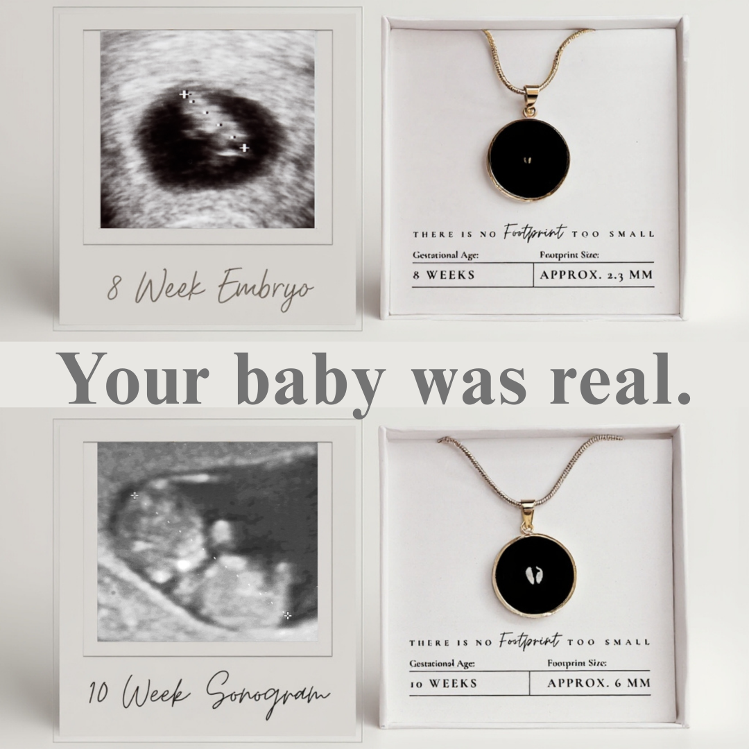 MyJuly27 Facebook ad: .because your baby matters.