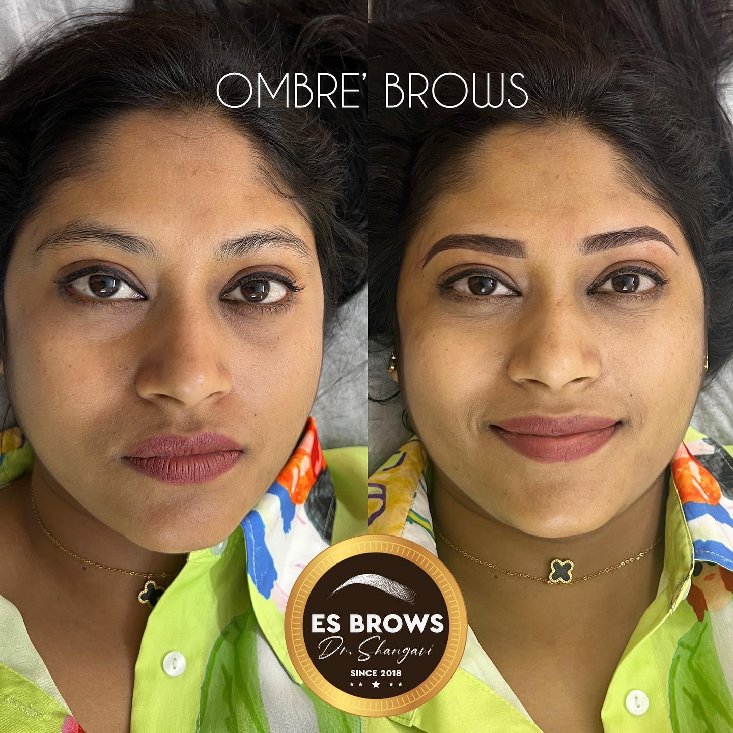 Esthetica by Dr.Shangavi Facebook ad: Flawless Brows, Every Day!