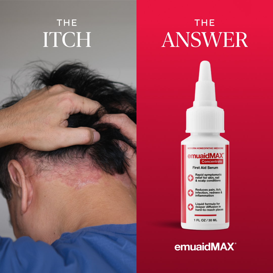 Emuaid Facebook ad