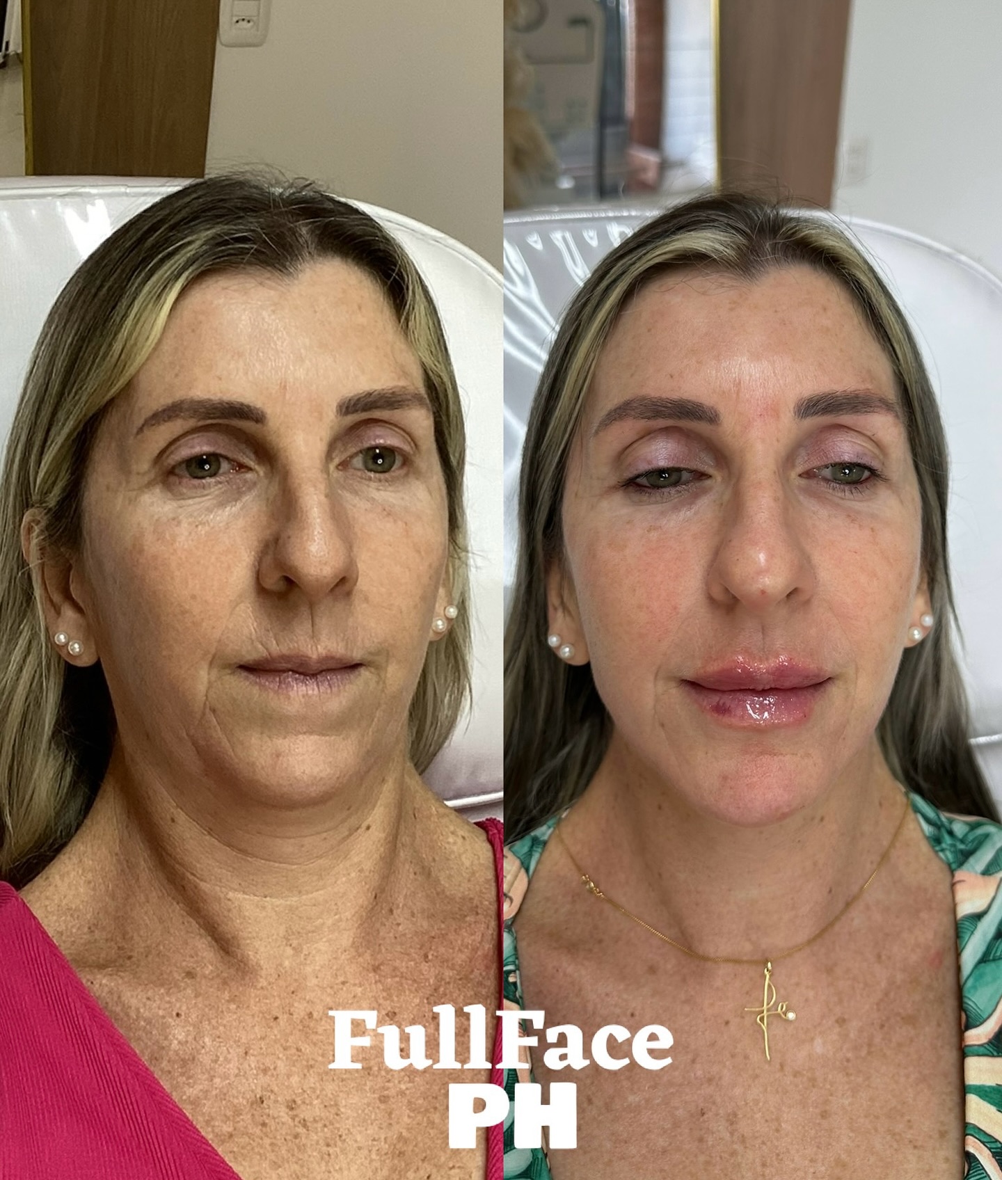 drapatriciaharff Facebook ad: A primeira foto foi tirada em um momento…