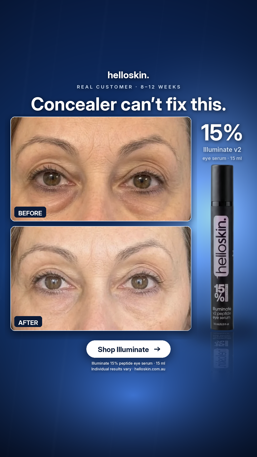 Helloskin Facebook ad: Concealer can’t fix this.