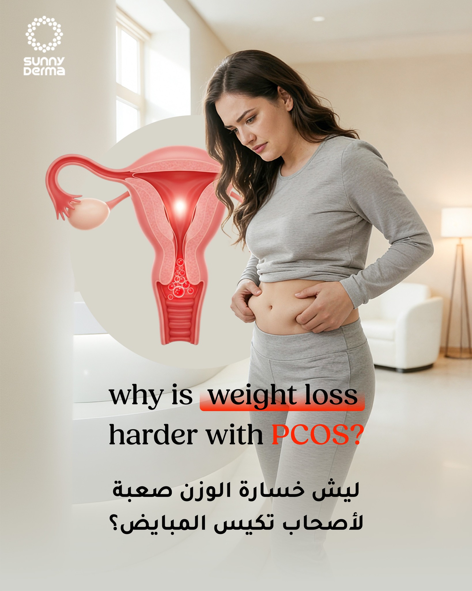 Sunny Derma Facebook ad: تعانين من تكيس المبايض وصعوبة نزول الوزن؟