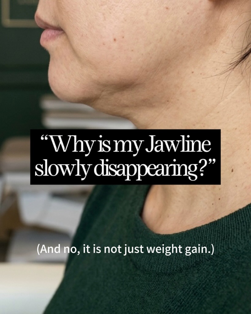 Skinstitute MD Facebook ad: Get to know the skinny on the gold…