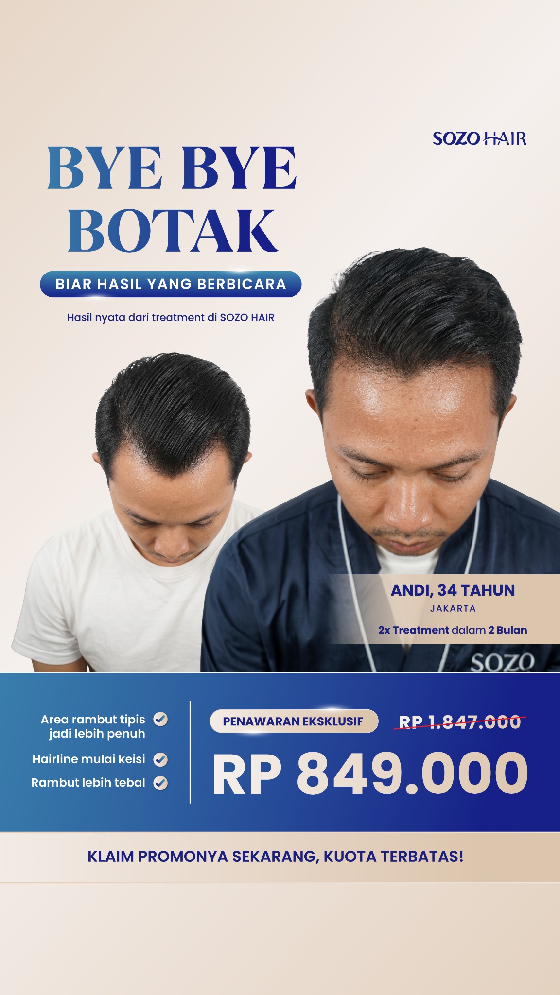 Sozo Skin Clinic Facebook ad