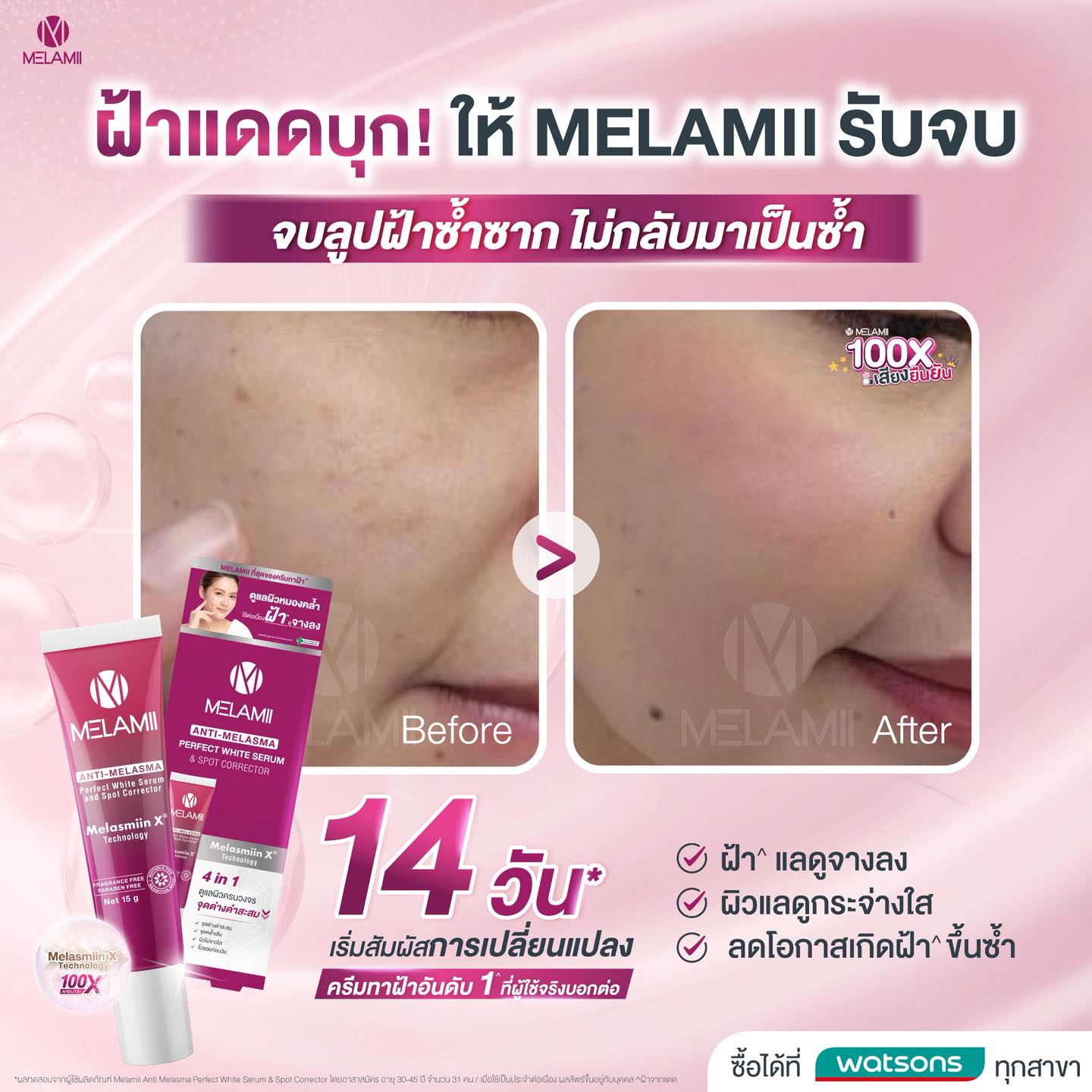 Melamii Anti Melasma Club Facebook ad
