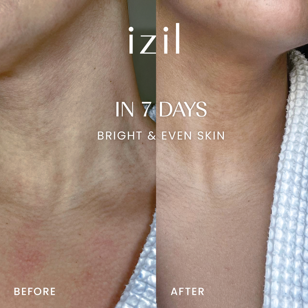 IZIL Beauty Facebook ad