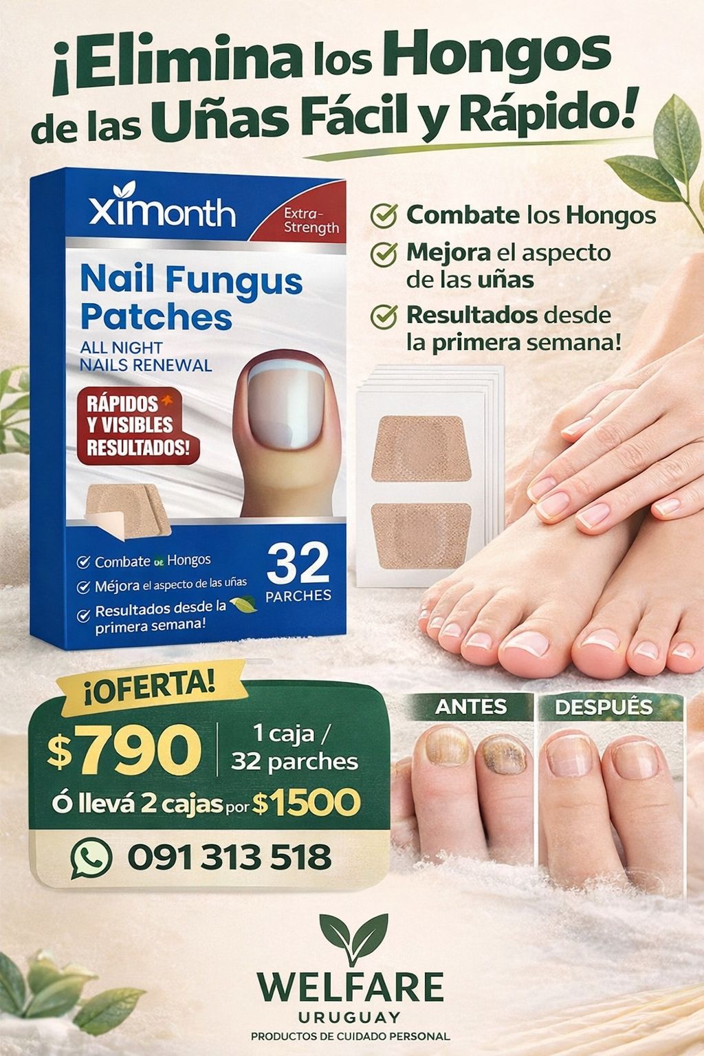 welfare Uruguay Facebook ad: ¿Te da vergüenza mostrar tus uñas?