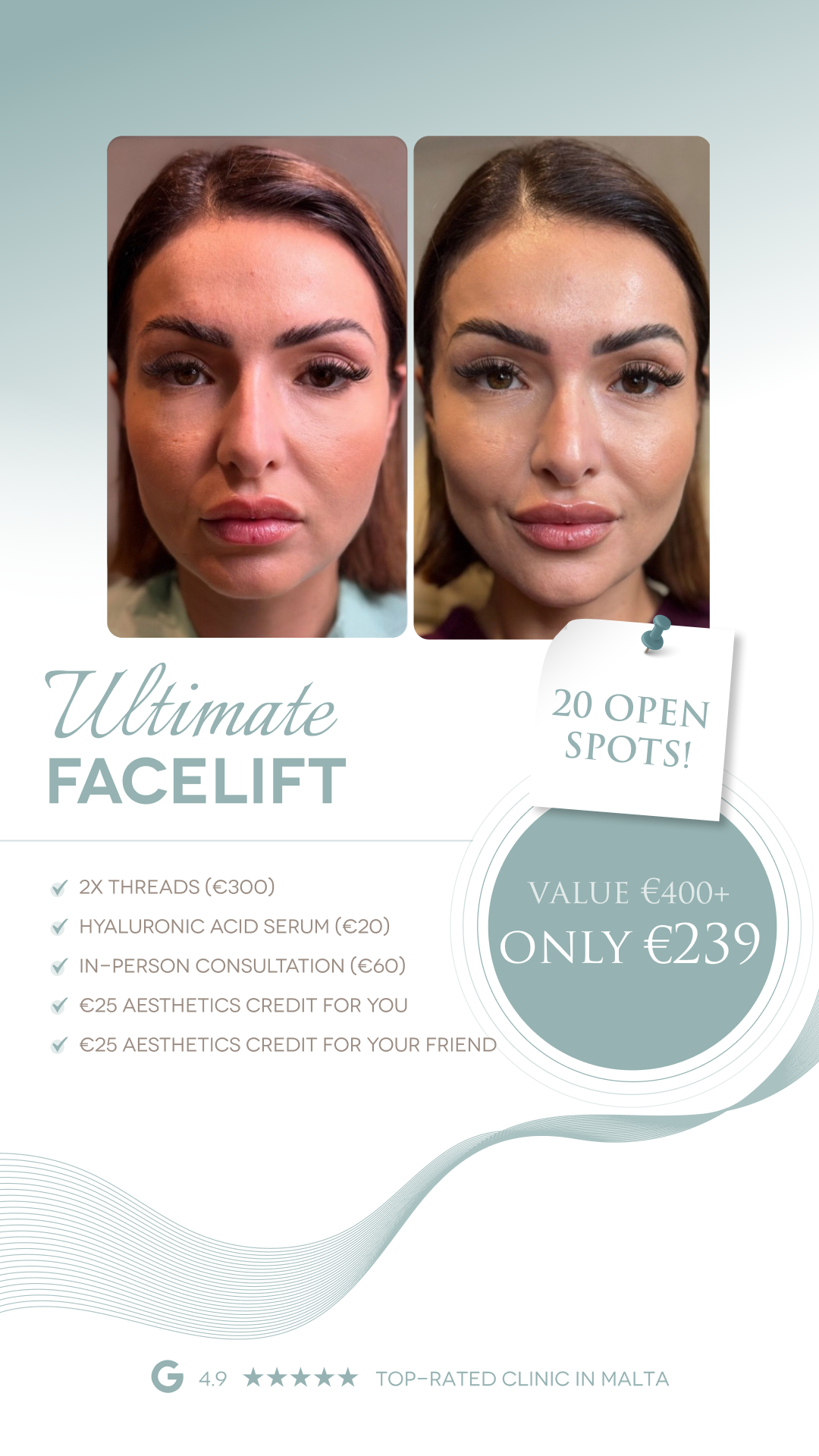 Carisma Aesthetics Facebook ad