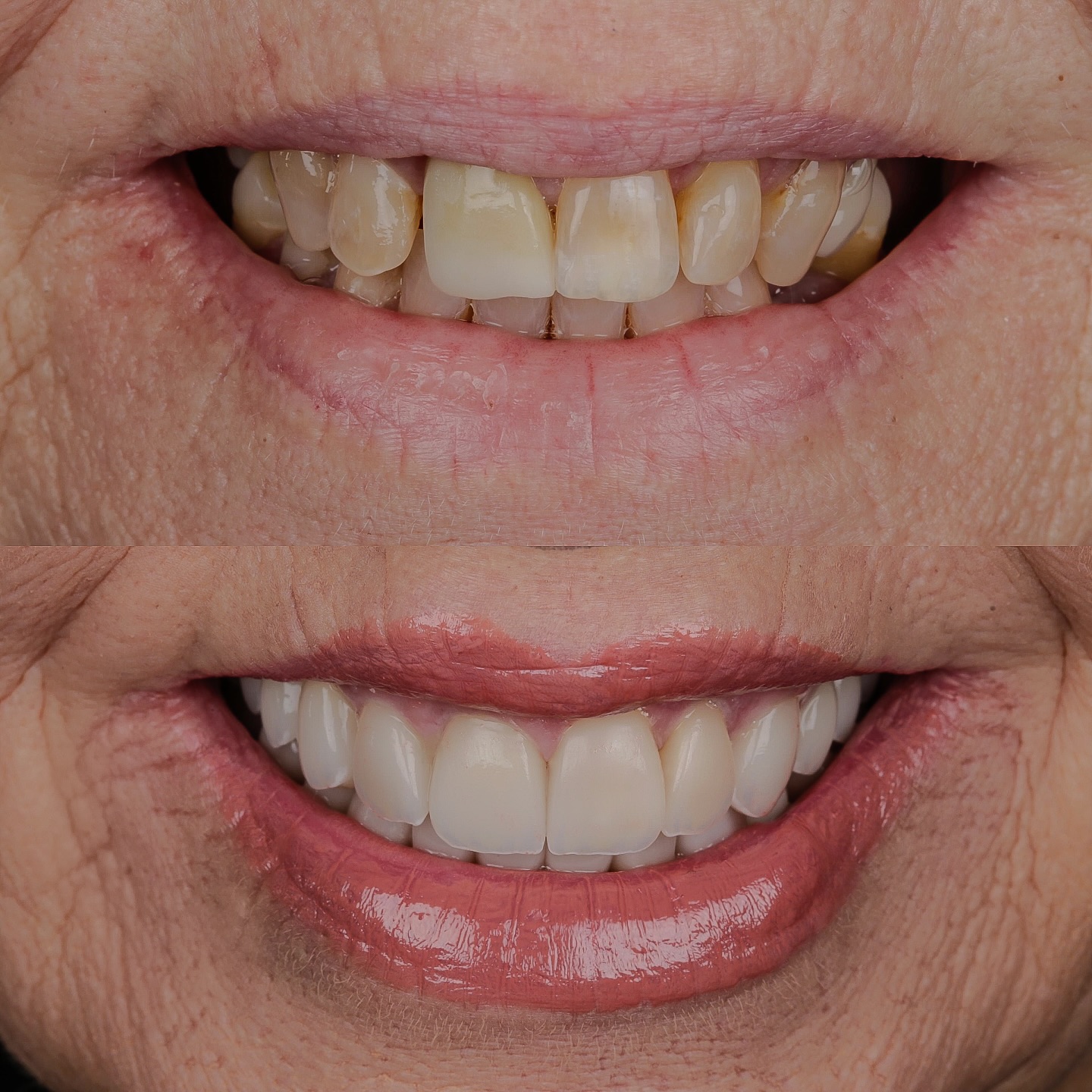 Rildo Lasmar Odontologia e Estética Facebook ad