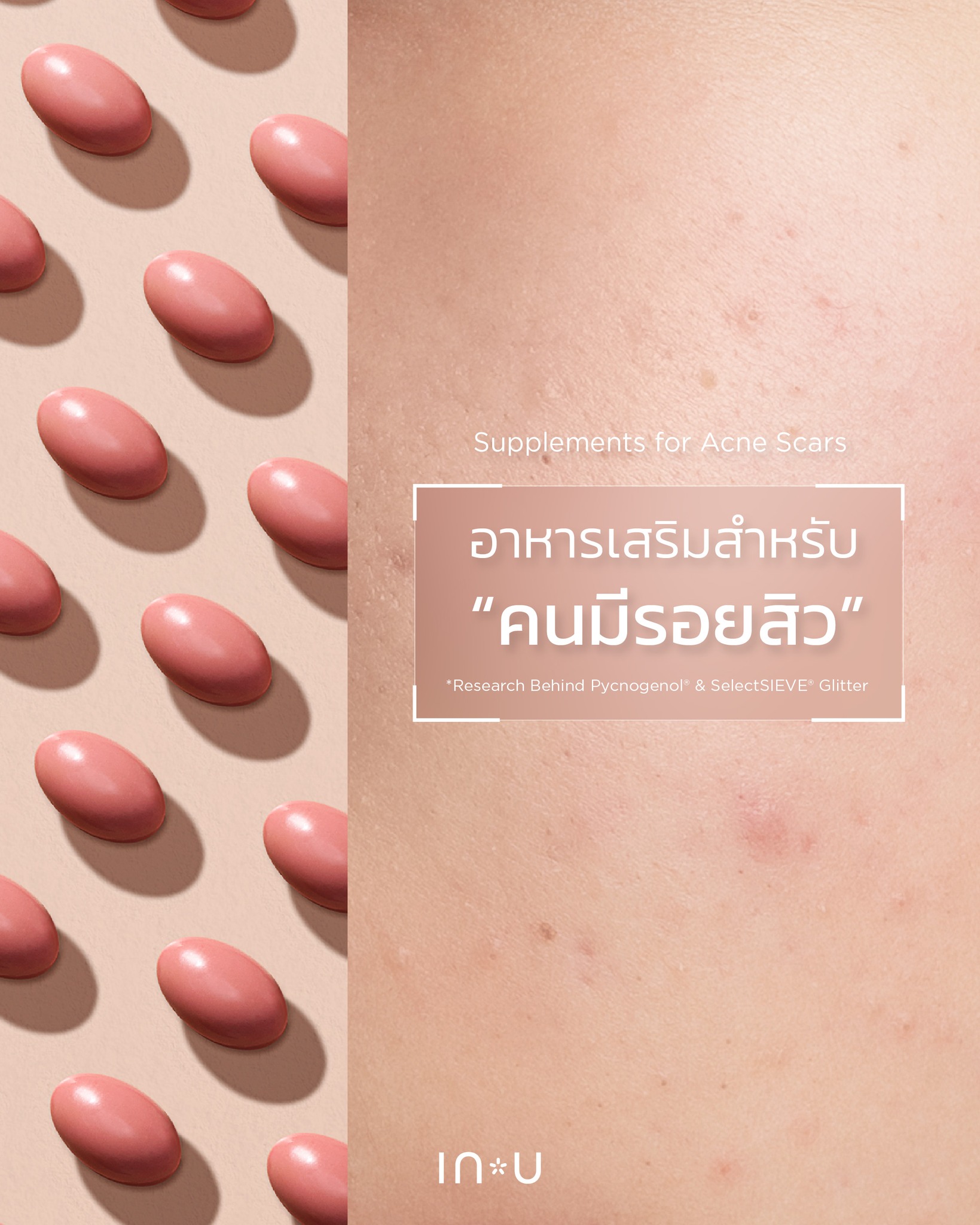IN U Supplement Facebook ad: IN U VitaGlow+ มีส่วนช่วยให้รอยสิว