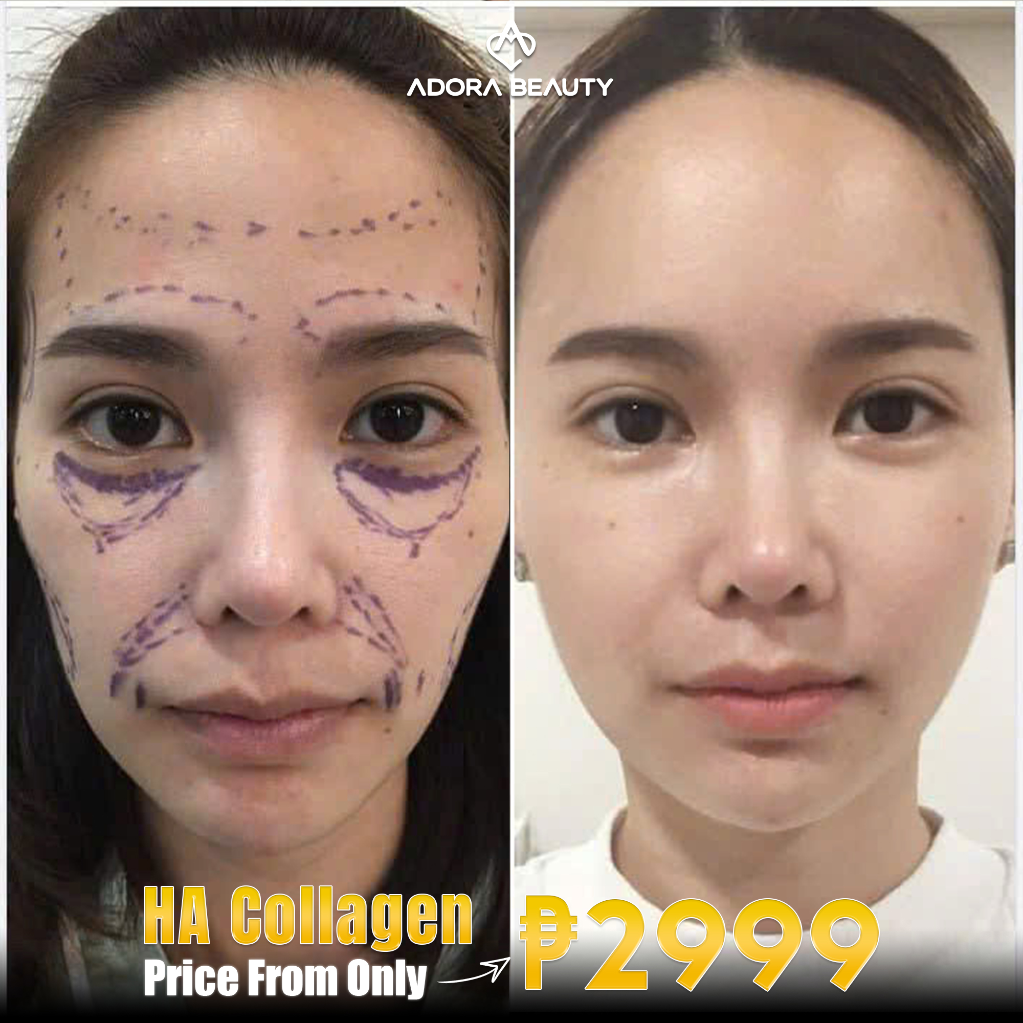 Adora Beauty Clinic in Manila Facebook ad